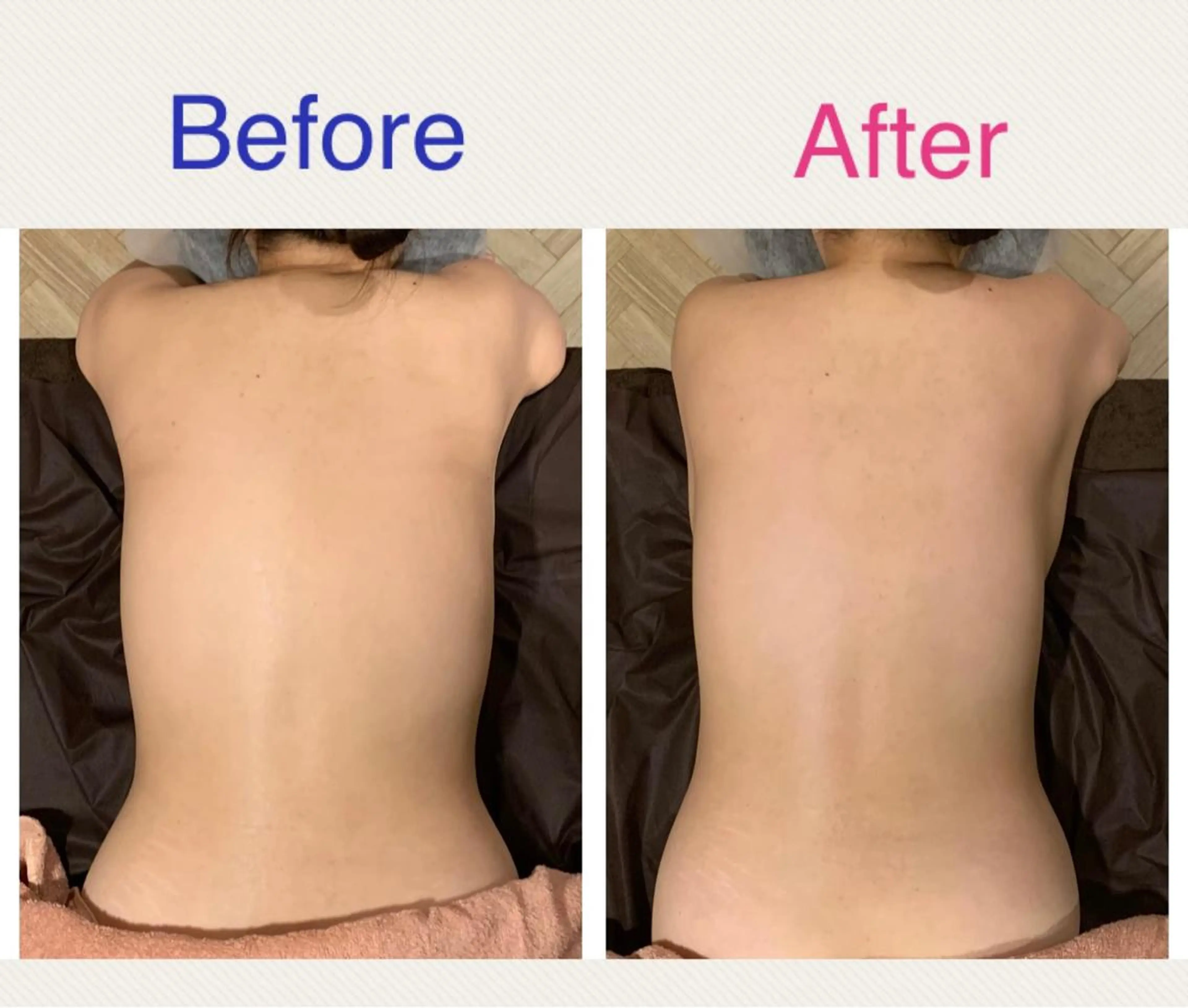 Rewhite -リホワイト-のエステ・リラクイメージ