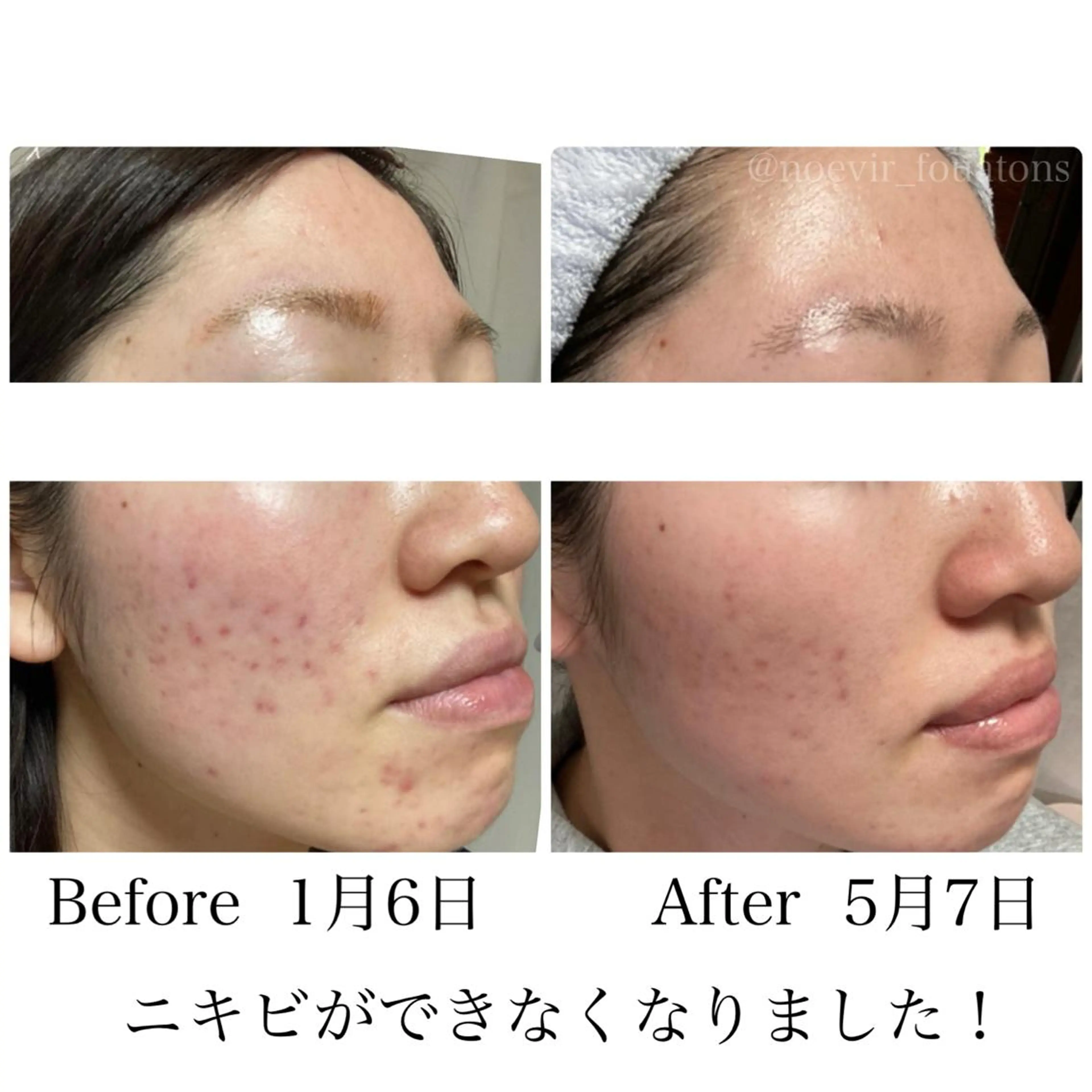 ﾌｪｲｼｬﾙｴｽﾃ ふわっとんのエステ・リラクイメージ