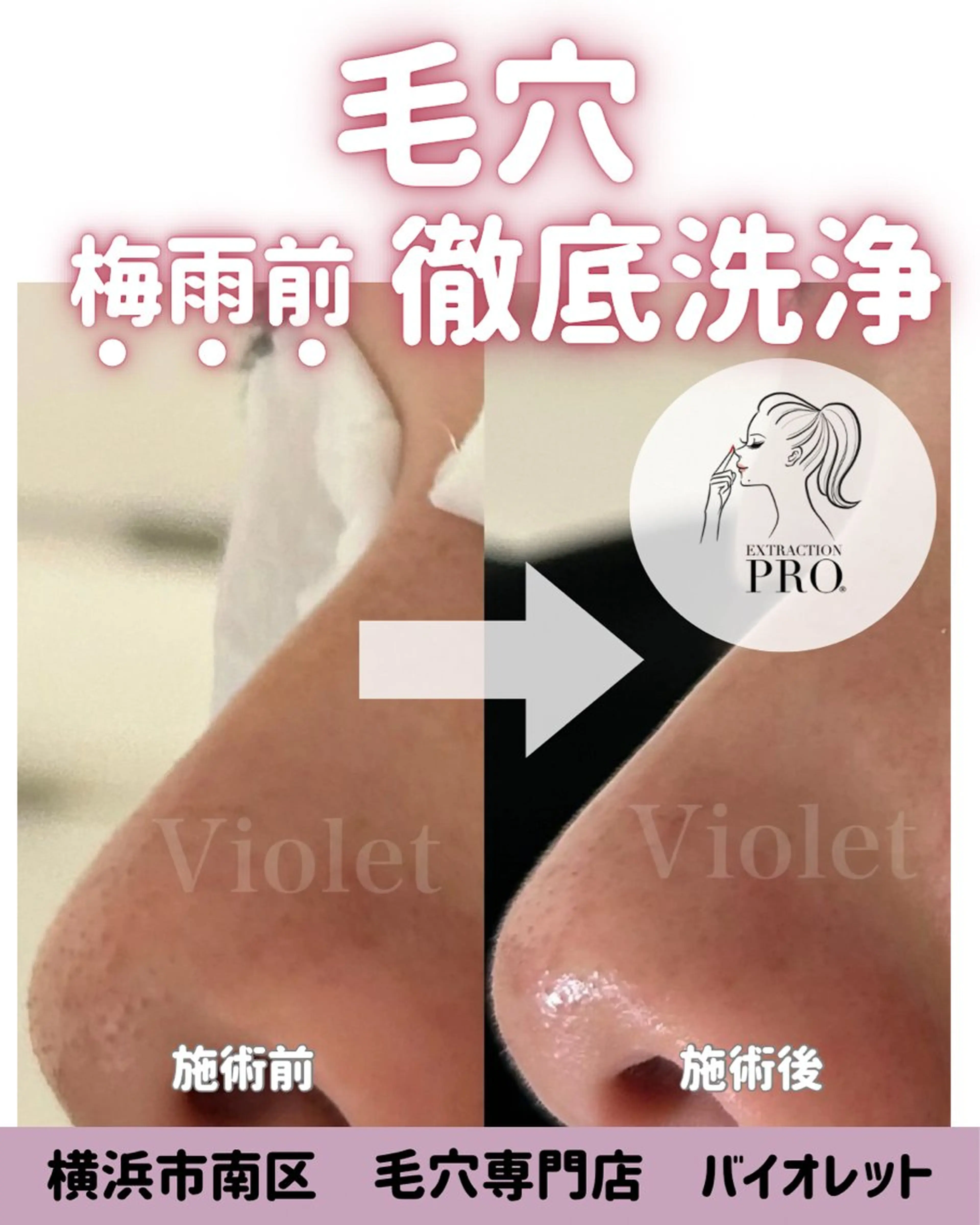 その他 毛穴と耳つぼ専門店 バイオレット　りののその他イメージ