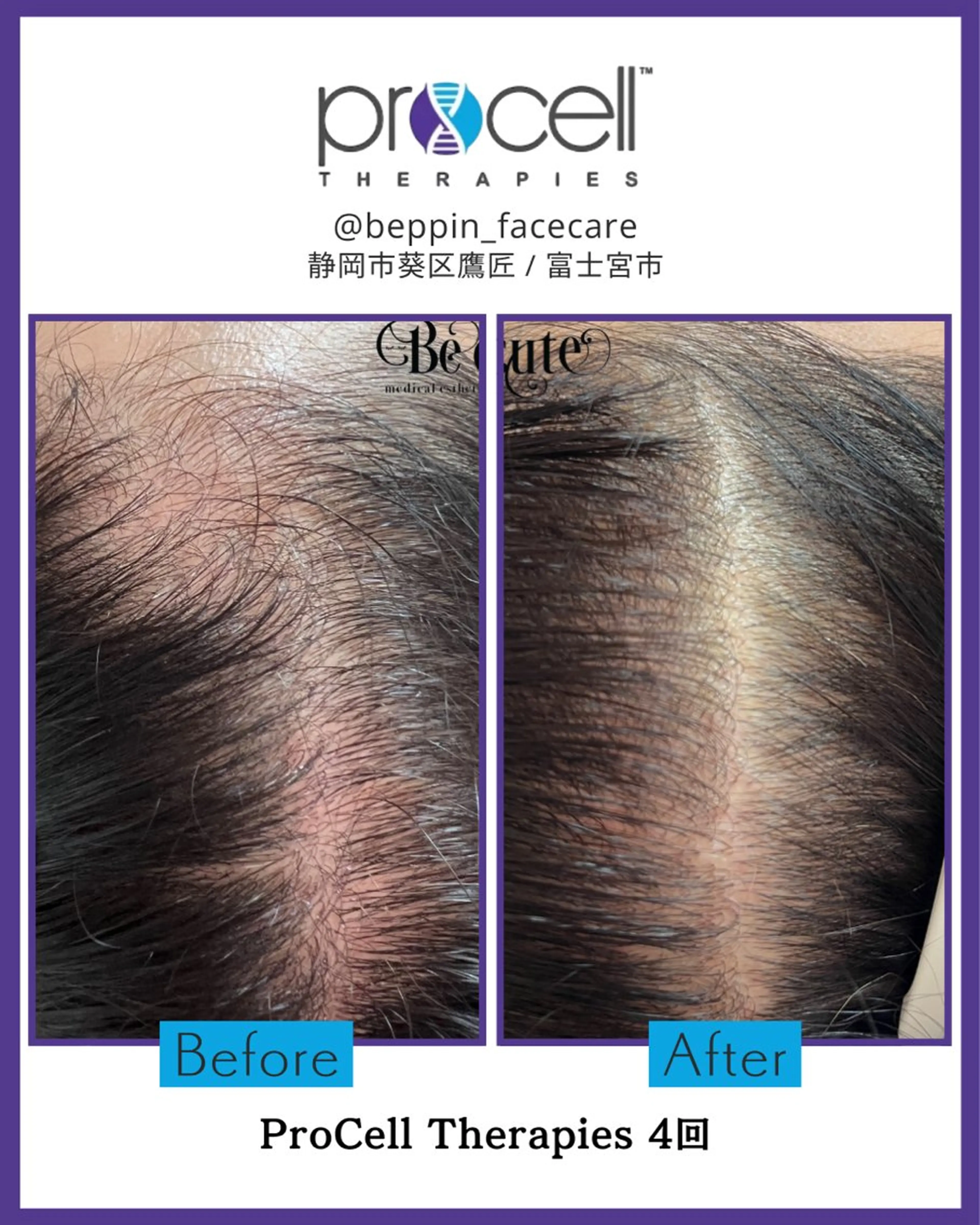 メンズ the 別嬪 静岡店所属・the 別嬪 静岡店のエステ・リラクイメージ