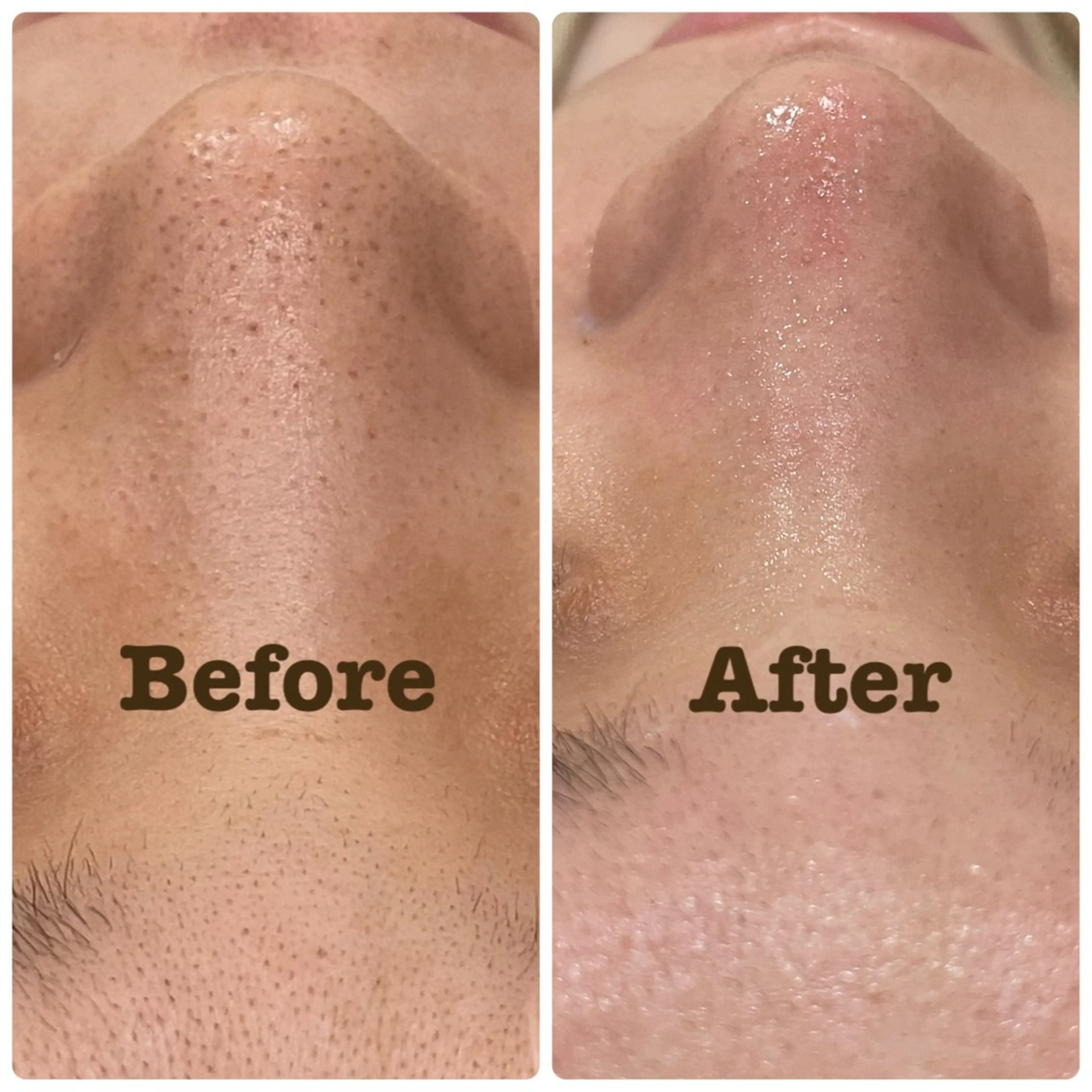 LiZA エステティックサロンのエステ・リラクイメージ