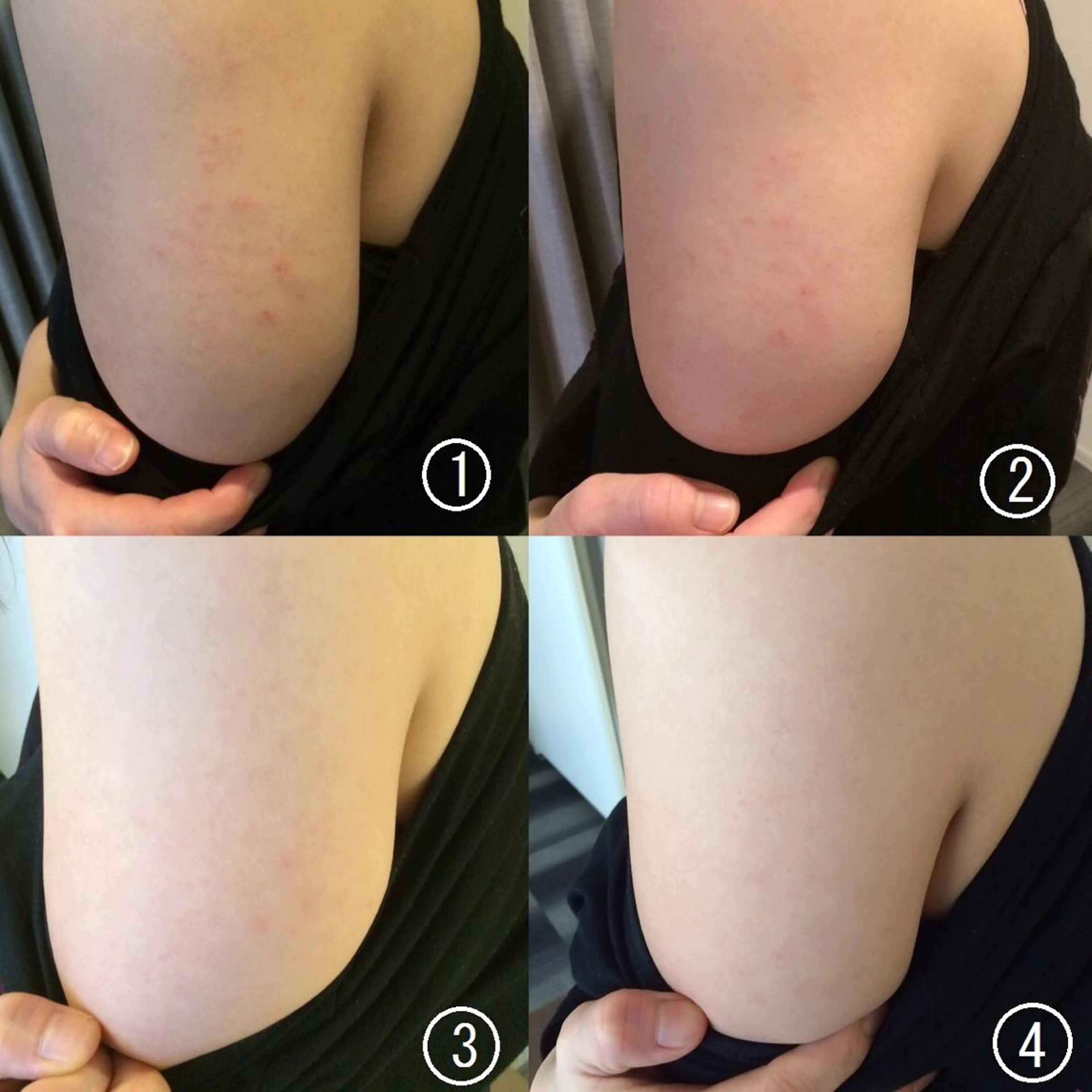 HappIness 遠赤外線ドームのエステ・リラクイメージ