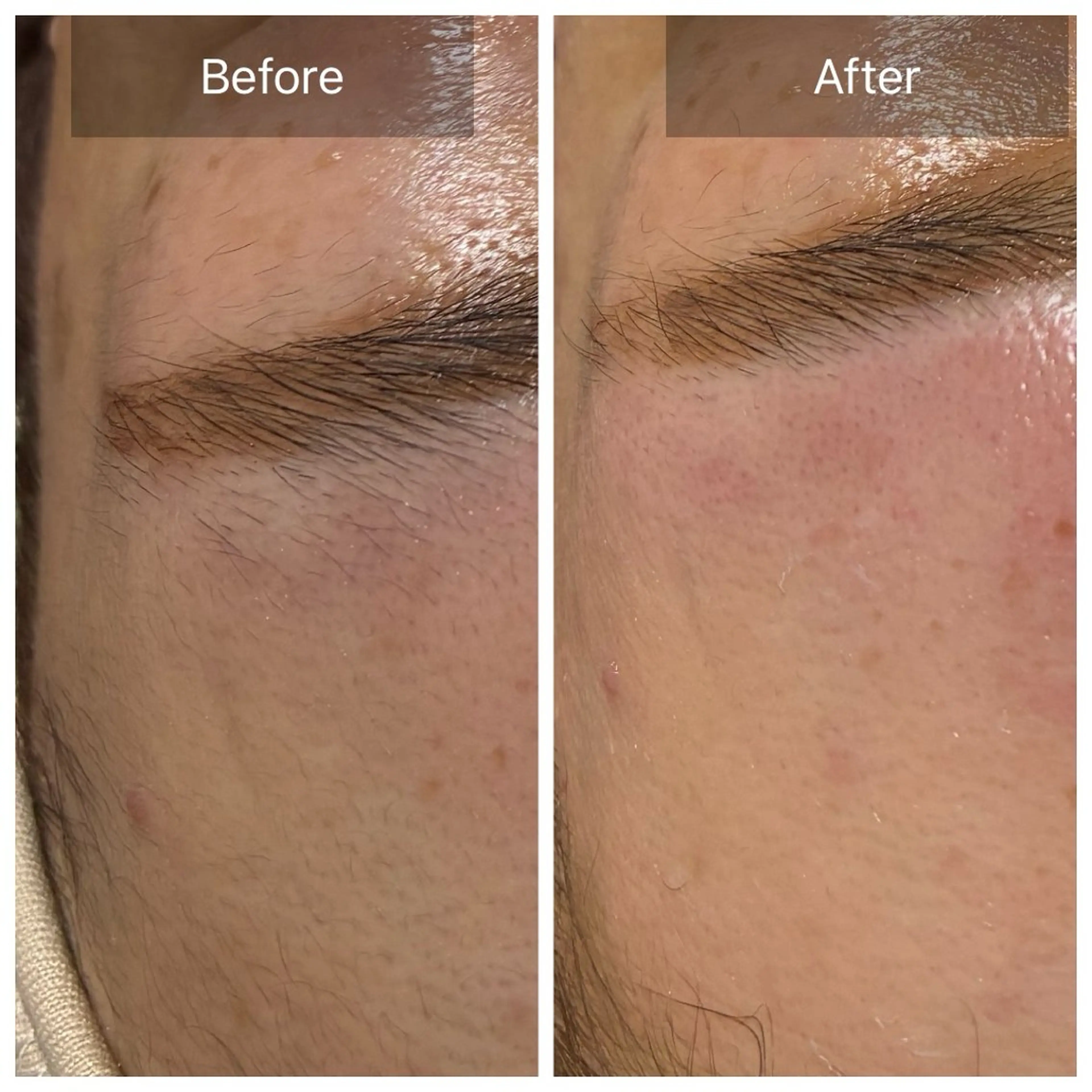 脱毛 産毛専門店 Bittoのエステ・リラクイメージ