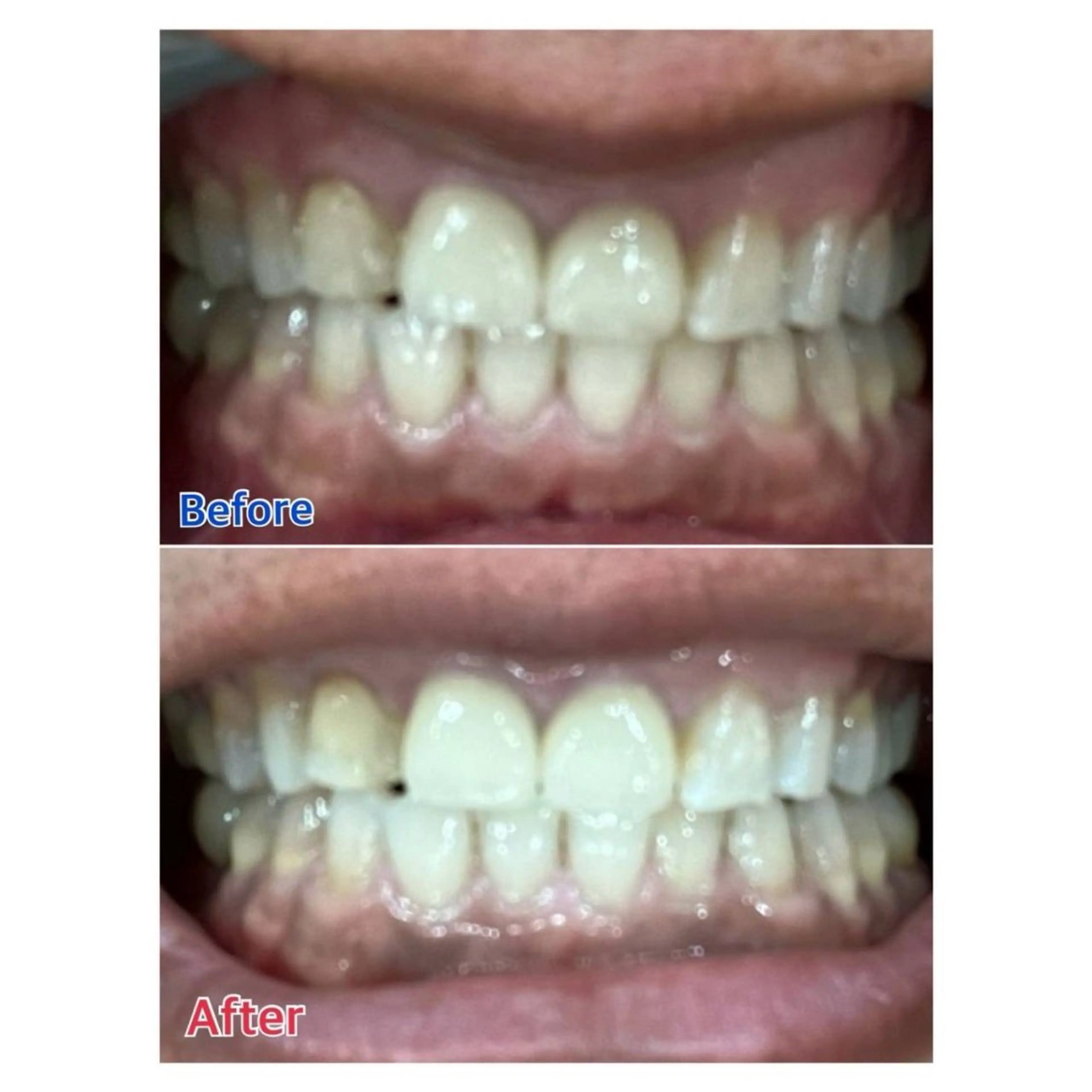 Melty 輝のその他イメージ