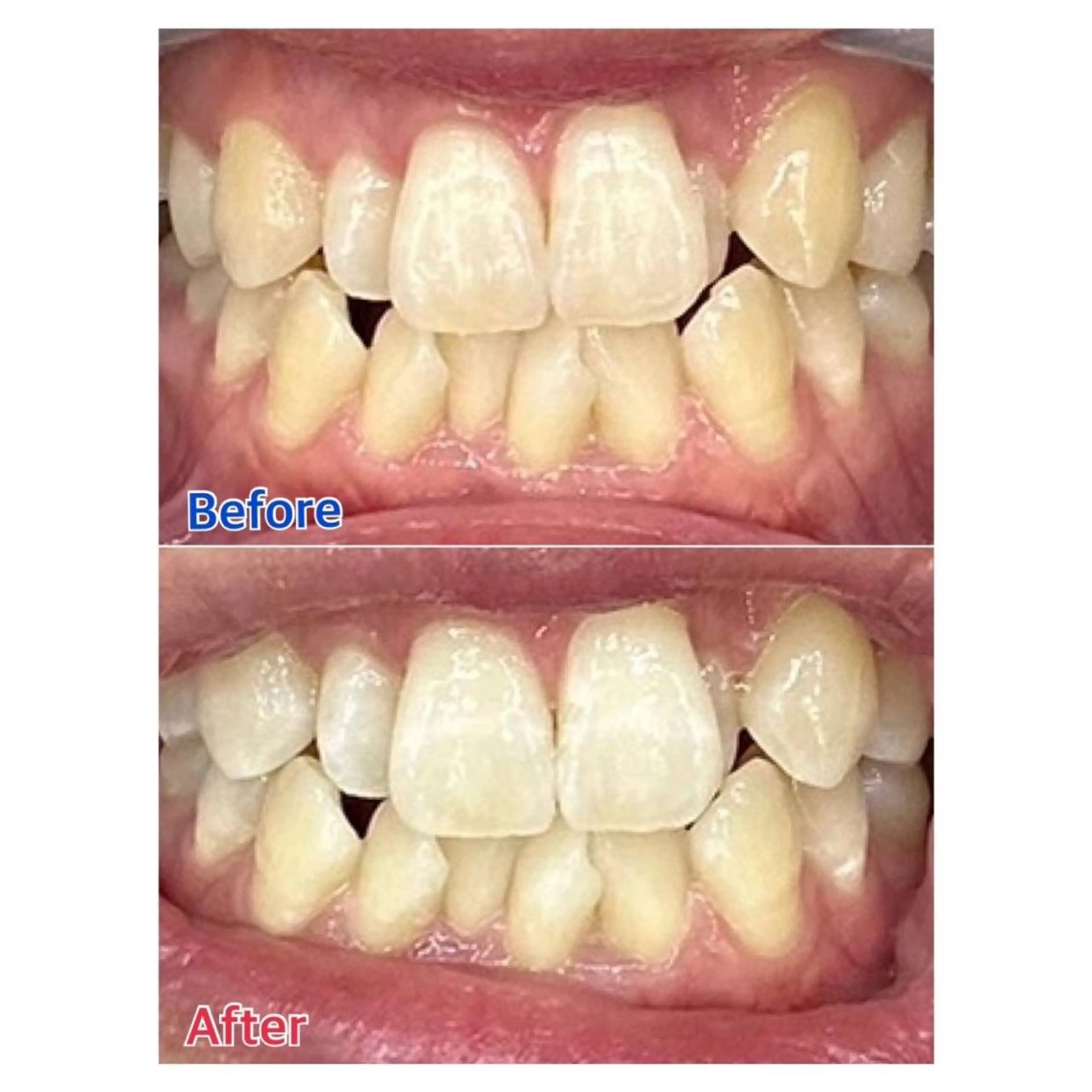 Melty 輝のその他イメージ