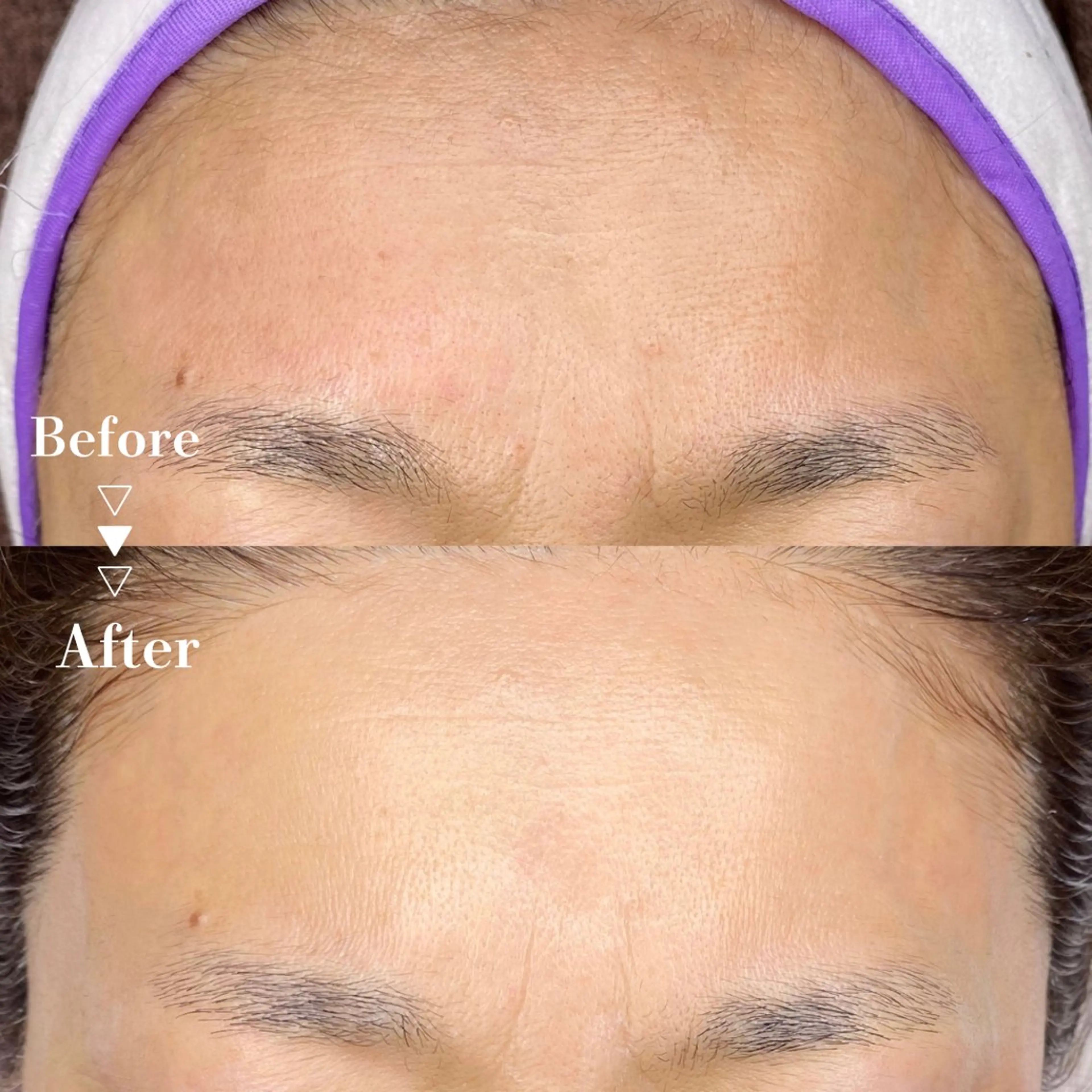 脱毛 Calone Itsukoのエステ・リラクイメージ