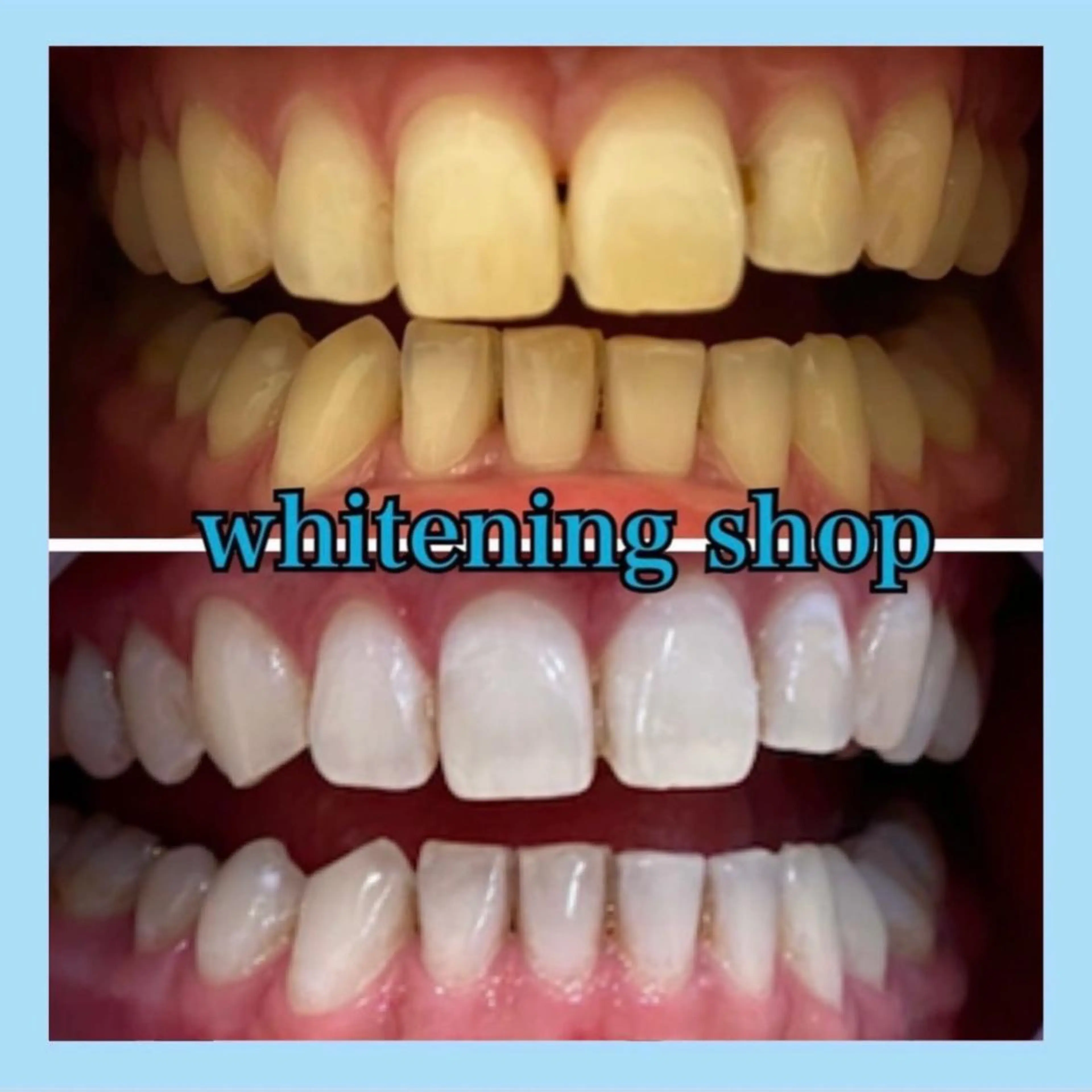 ホワイトニング ショップ千葉店のその他イメージ