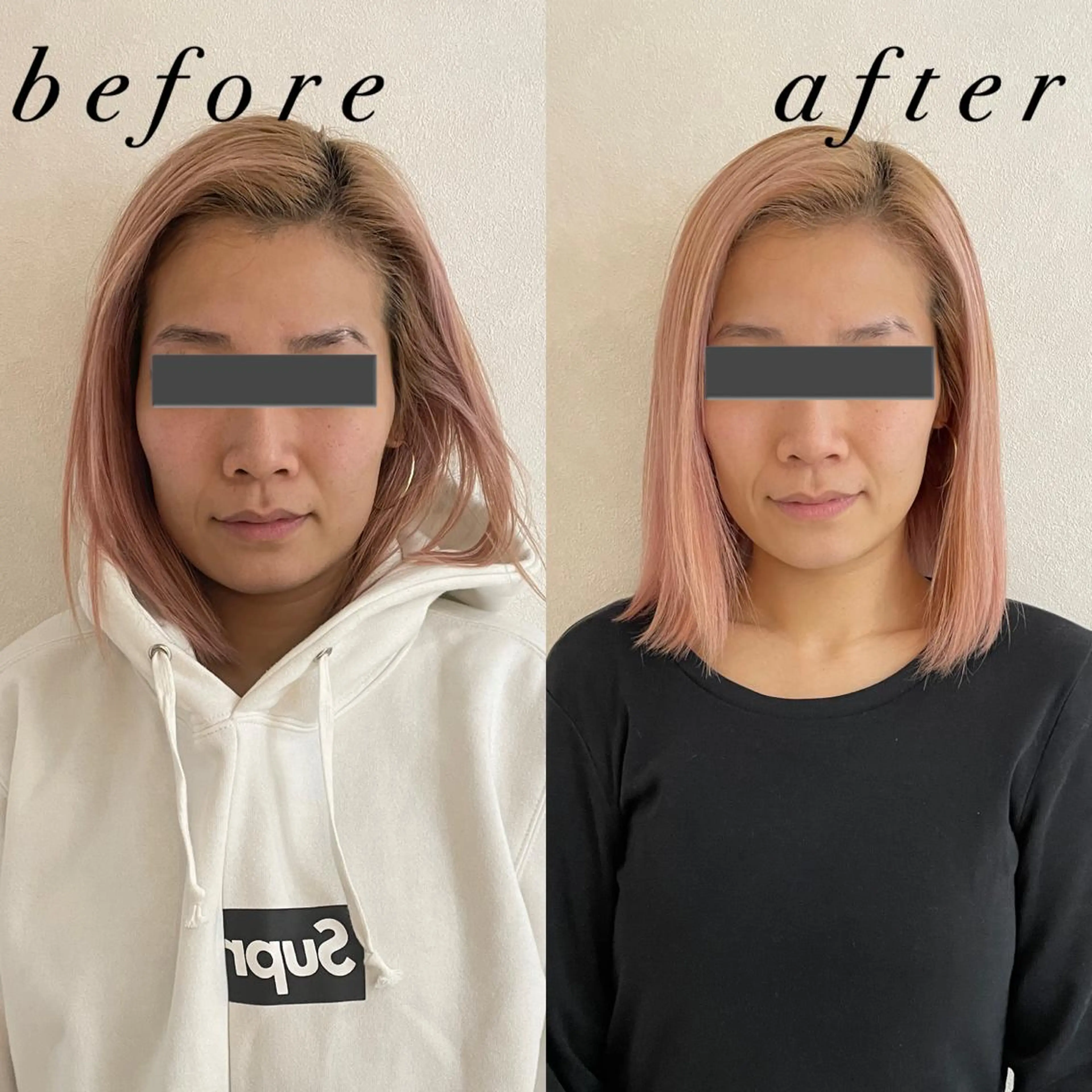 うなじ脱毛/美肌脱毛 LABELのエステ・リラクイメージ