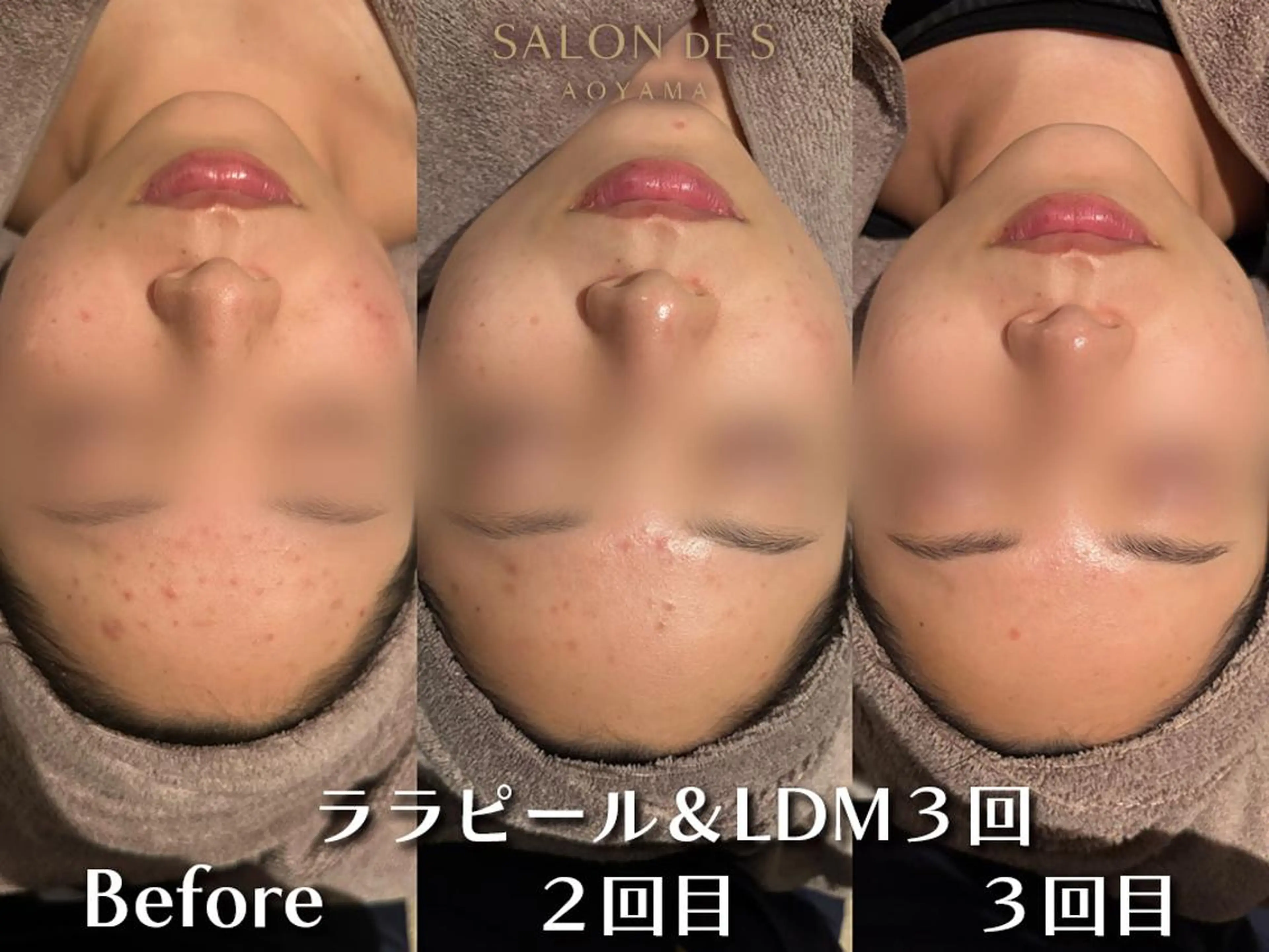 エステ SALON DE S 外苑前♡さやかのエステ・リラクイメージ