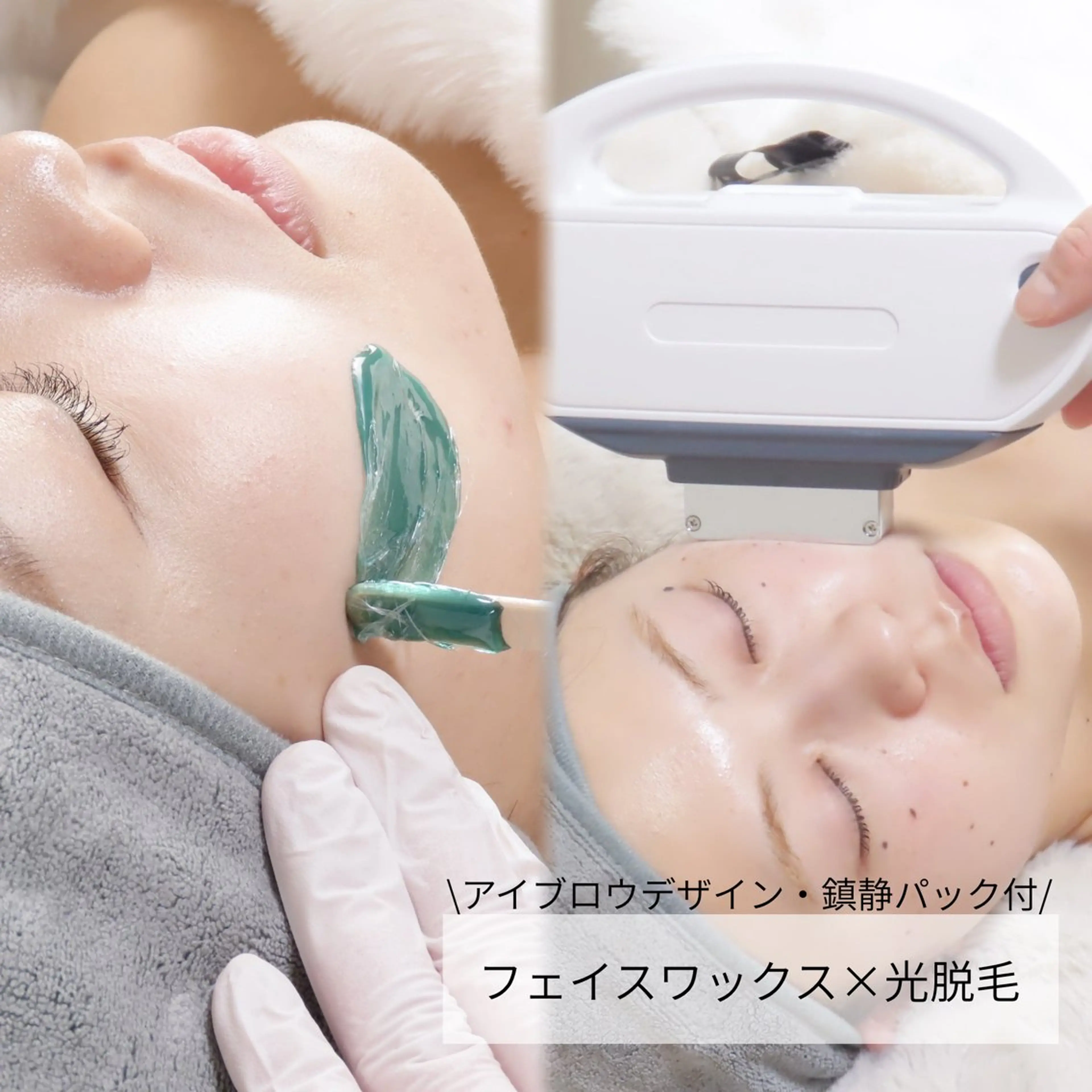 フェイスワックス脱毛＋光脱毛照射 ¥12,000→¥8,000 (鎮静パック・アイブロウデザイン付)の写真