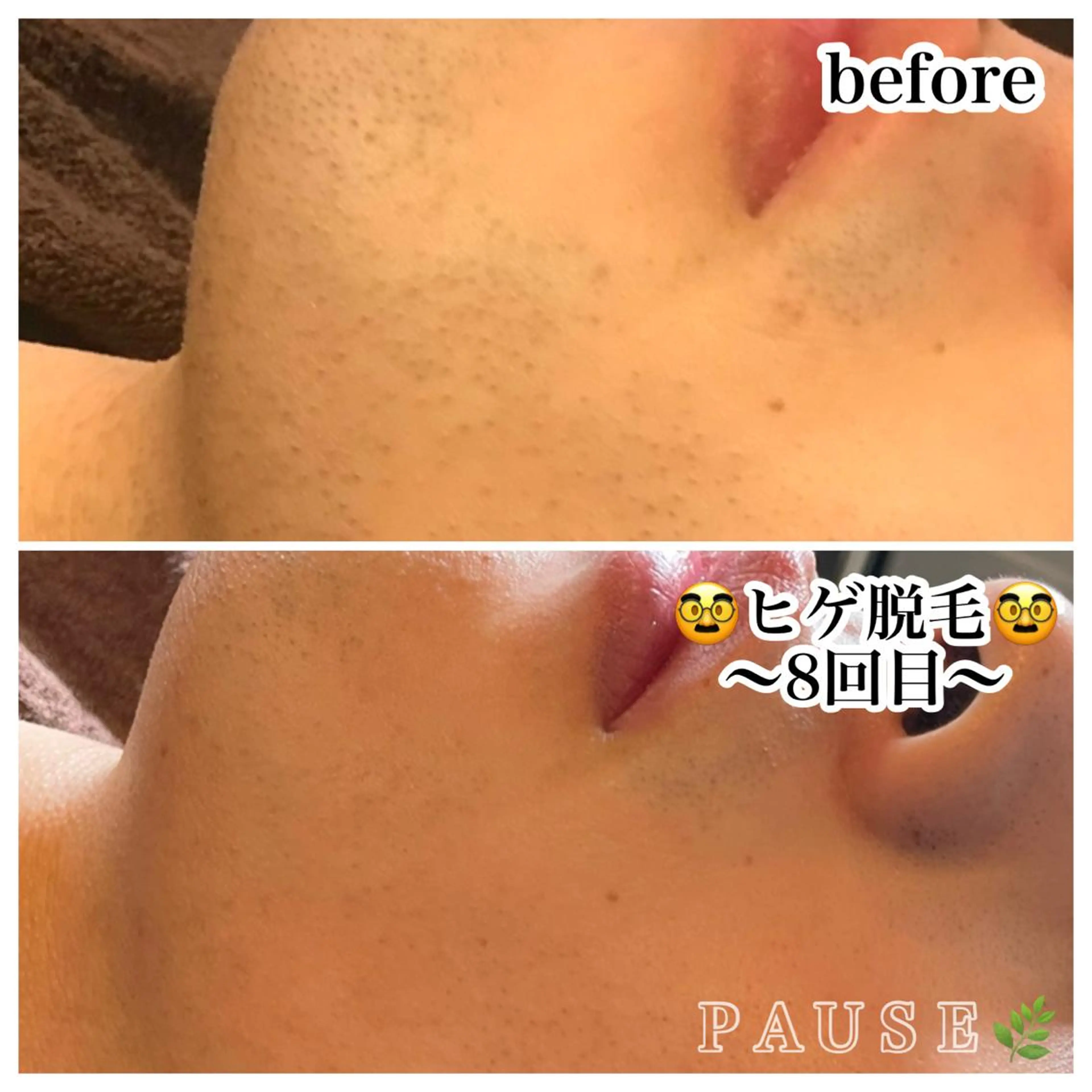 脱毛 浜野 恵美のエステ・リラクイメージ