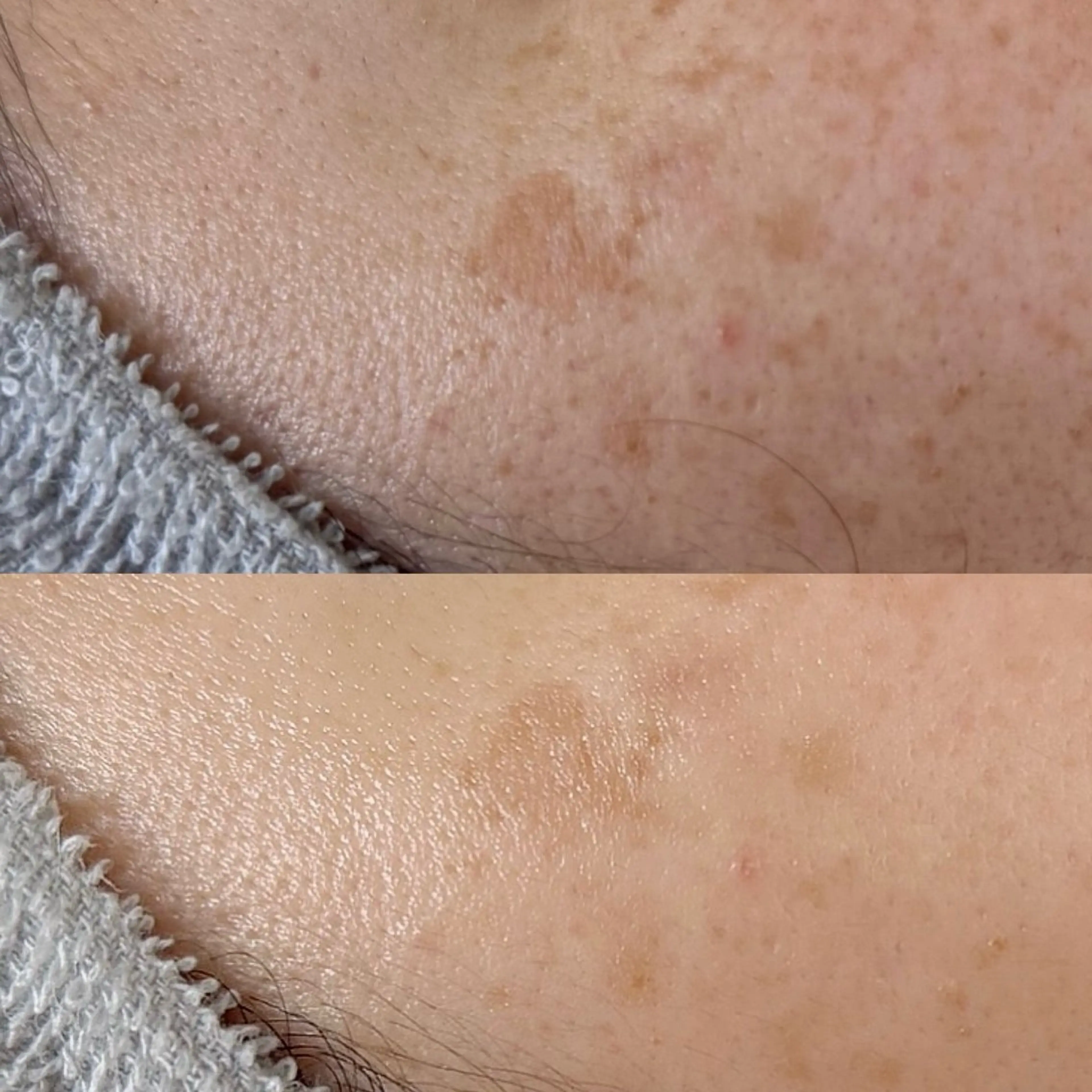 Rairy Salon富士見町のエステ・リラクイメージ