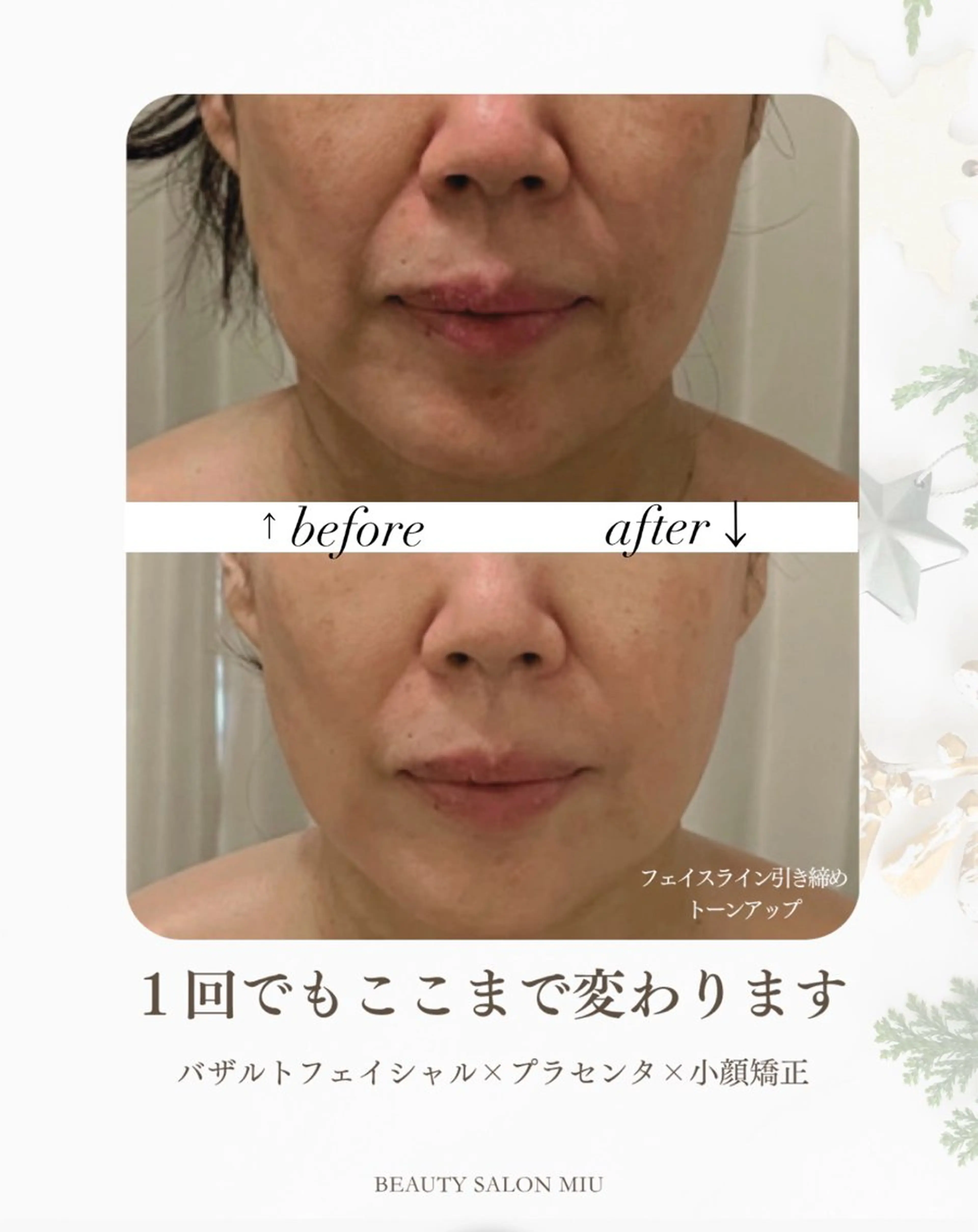 エステ 35歳からの エイジングケアサロンのエステ・リラクイメージ