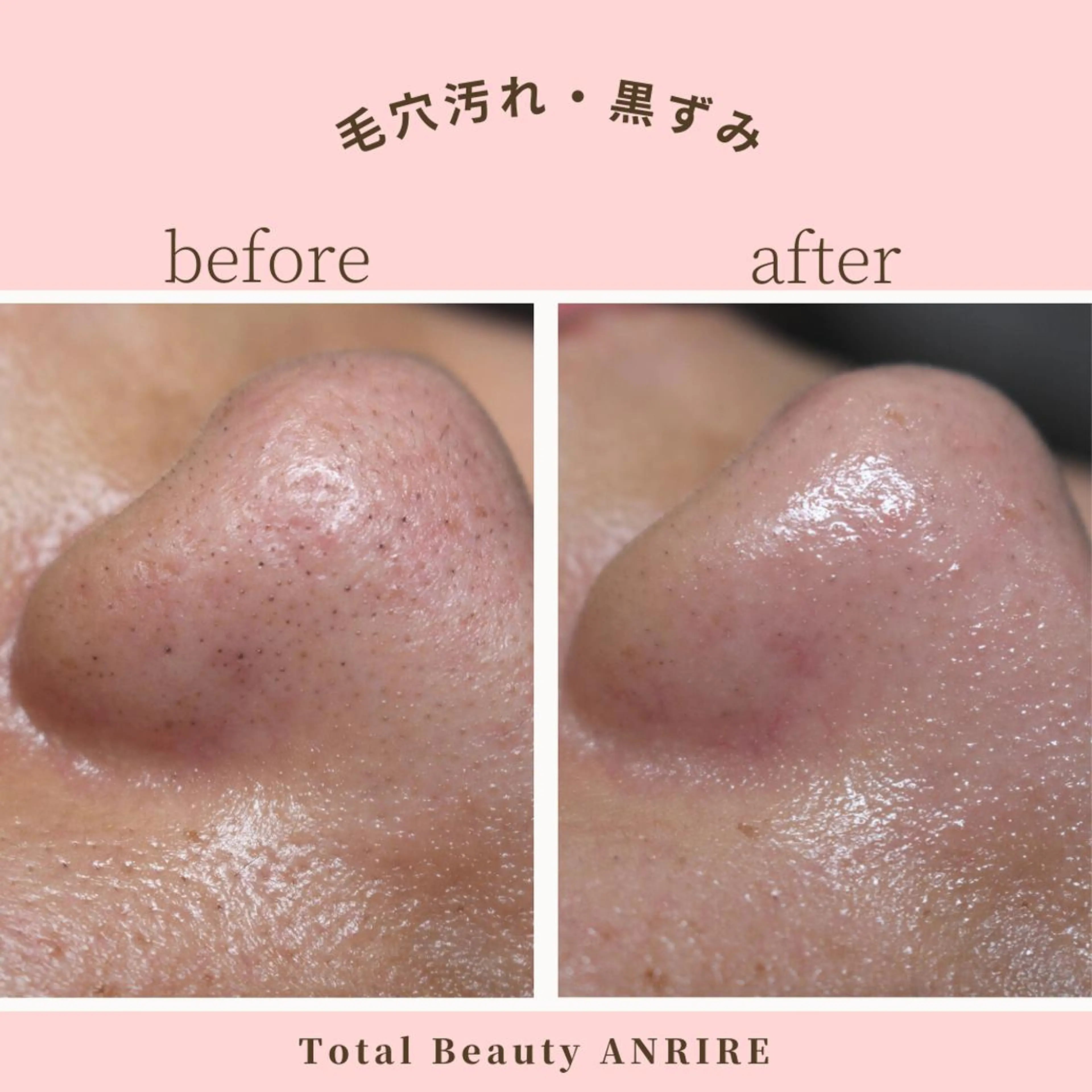 ANRIRE (アンリール)のエステ・リラクイメージ