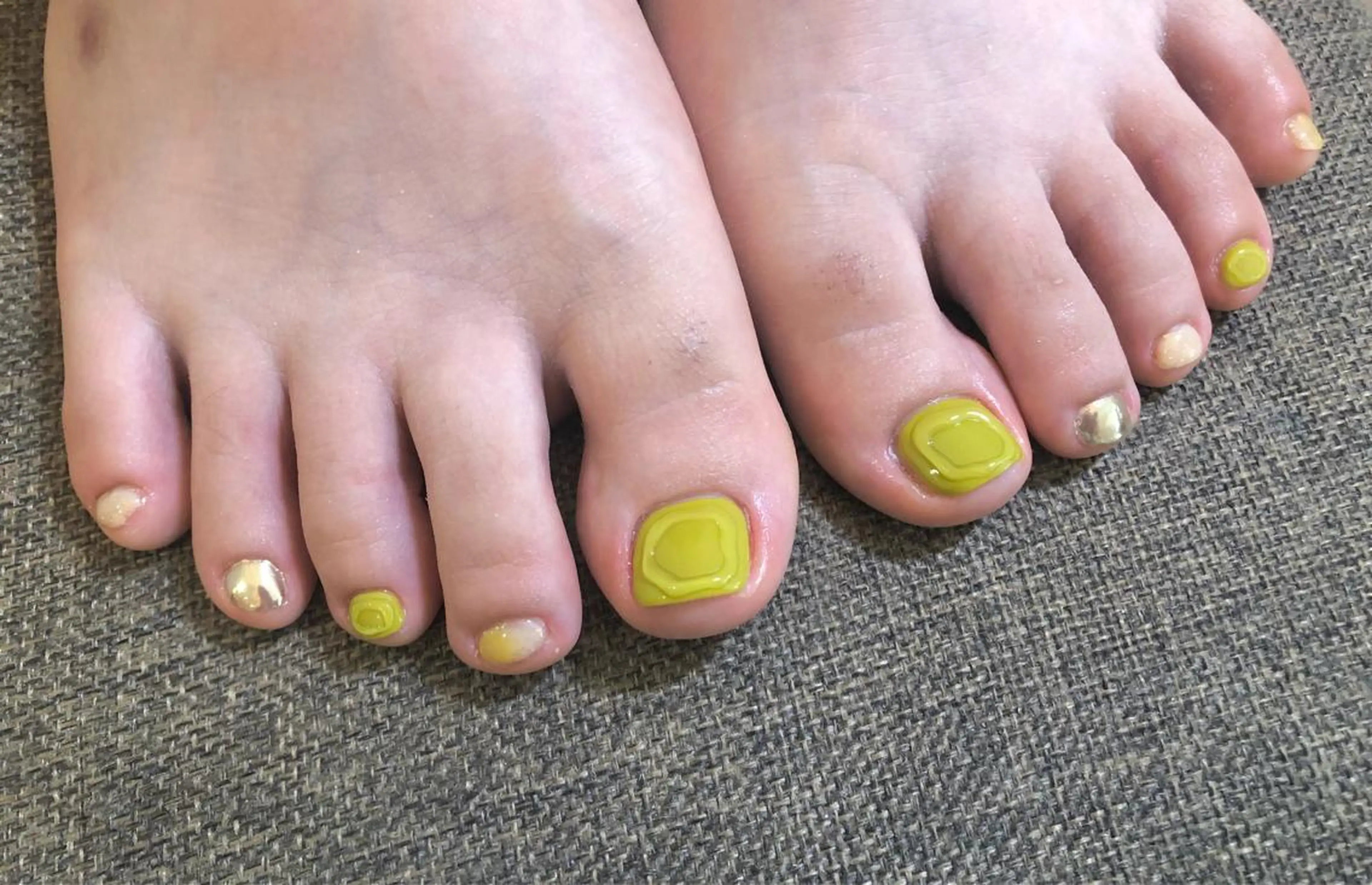 ネイル アートネイル フットネイル フットネイル いちじゅう あおいのネイルデザイン