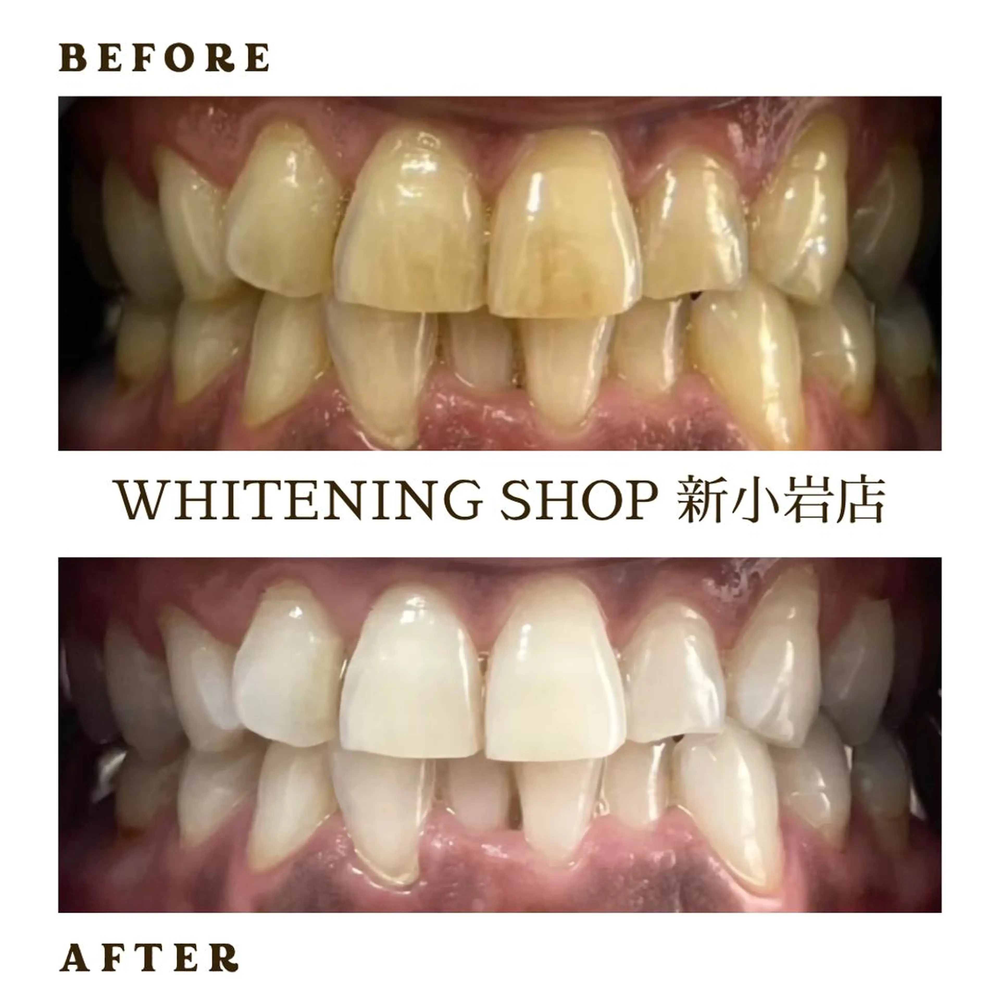 メンズ その他 ホワイトニング ショップ新小岩店のその他イメージ
