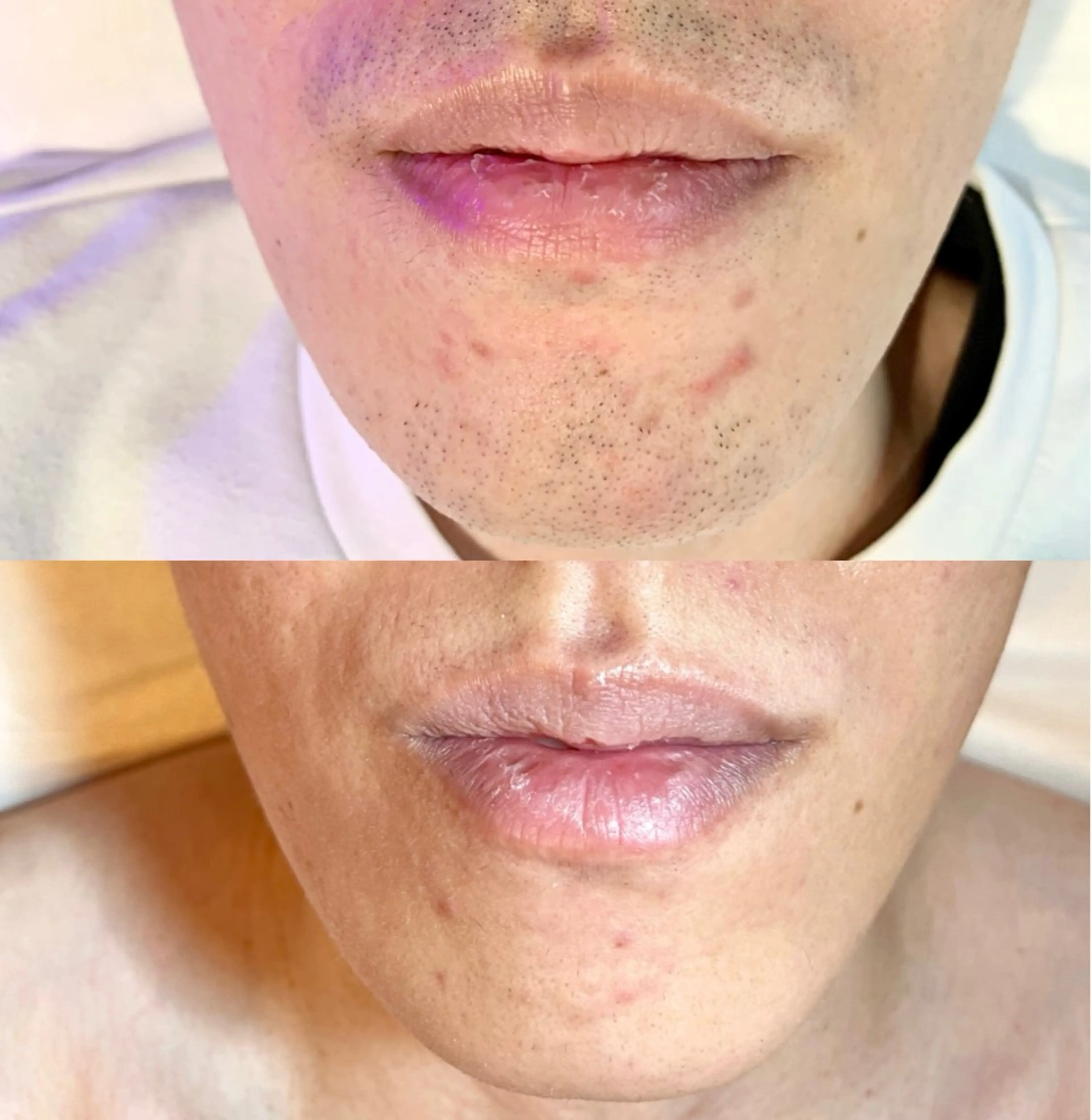 脱毛 Lokahi所属・脱毛サロン Lokahiのエステ・リラクイメージ