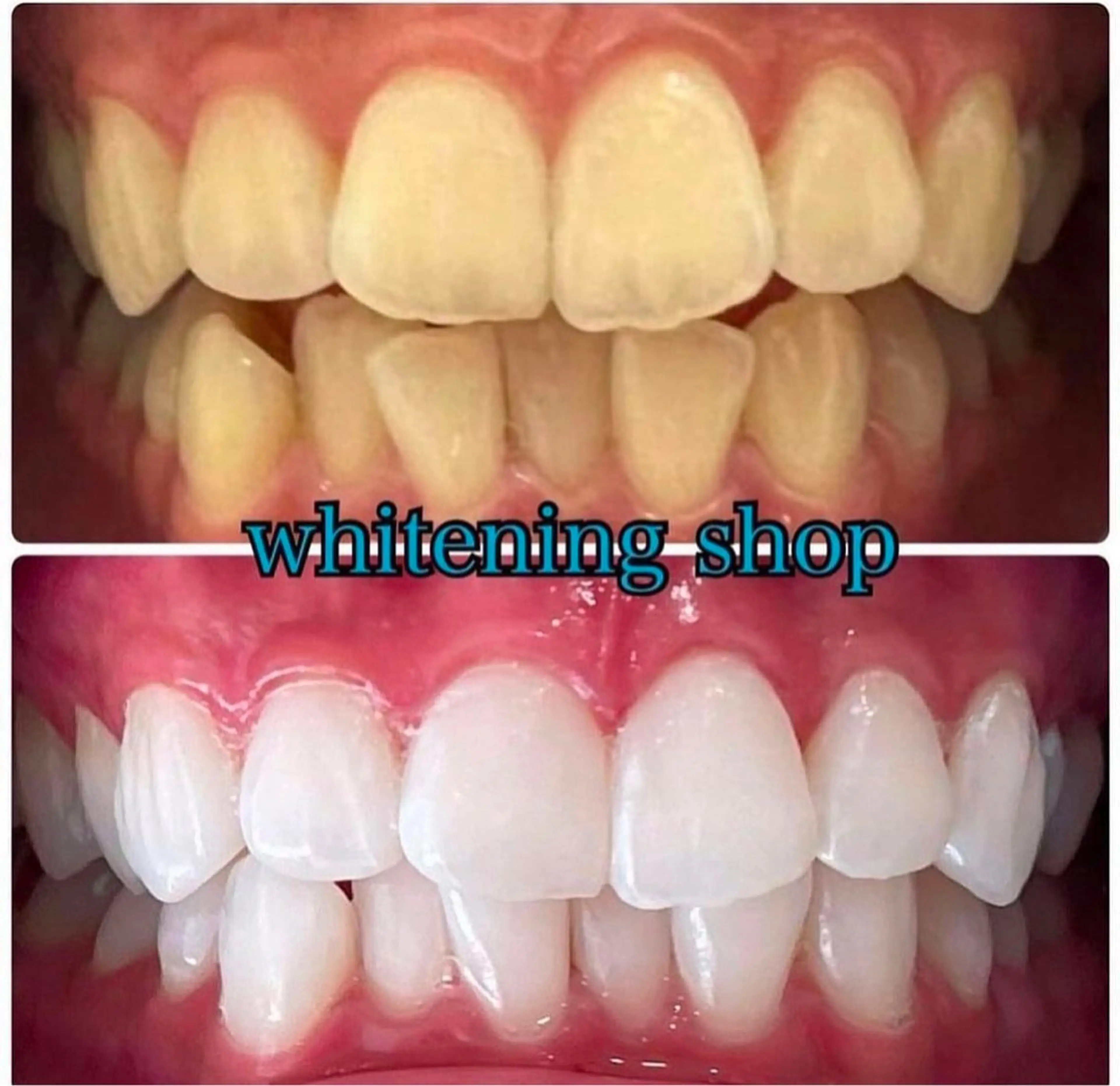 ホワイトニング ショップ伊丹店のその他イメージ