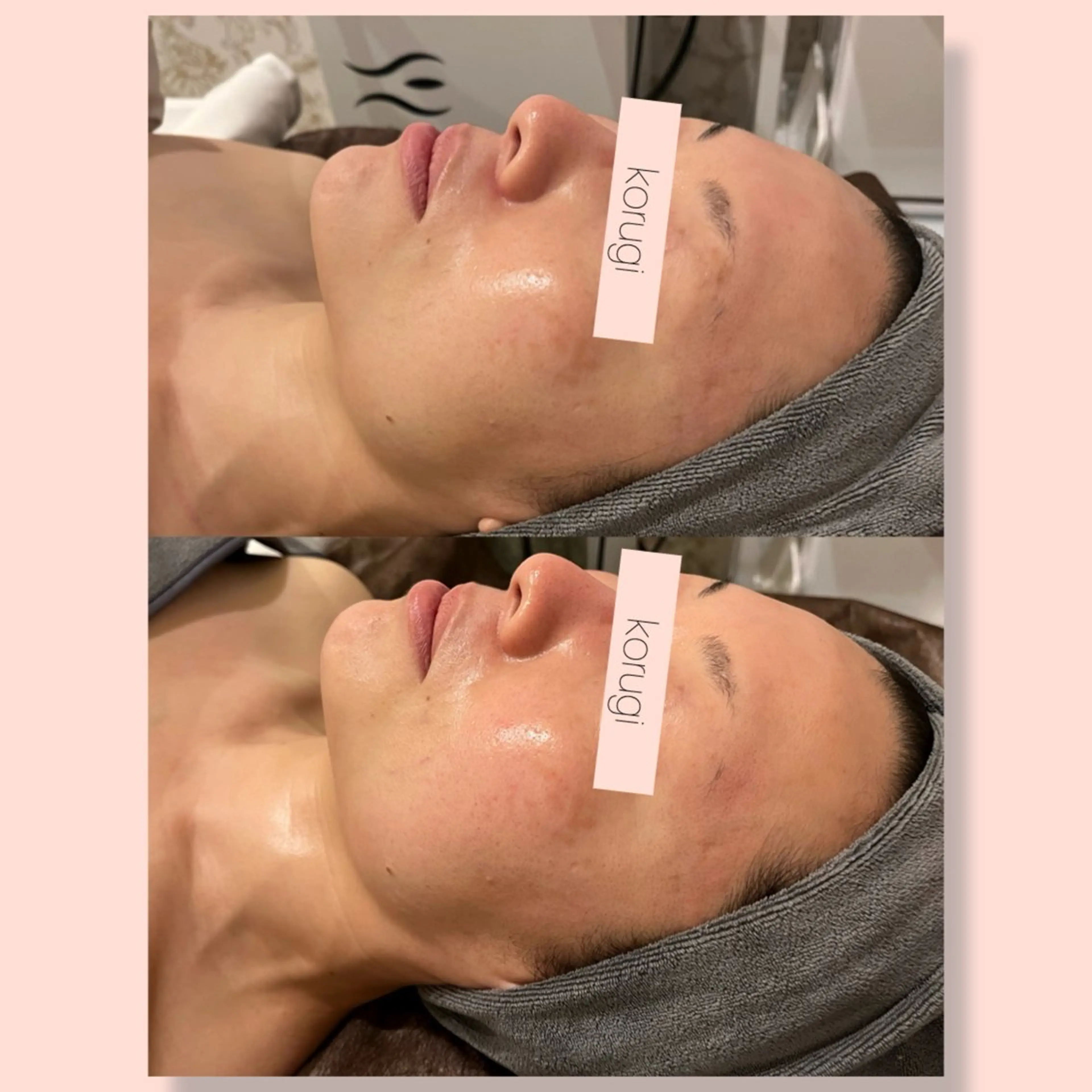 エステ 小顔コルギ ☆表参道/外苑前のエステ・リラクイメージ