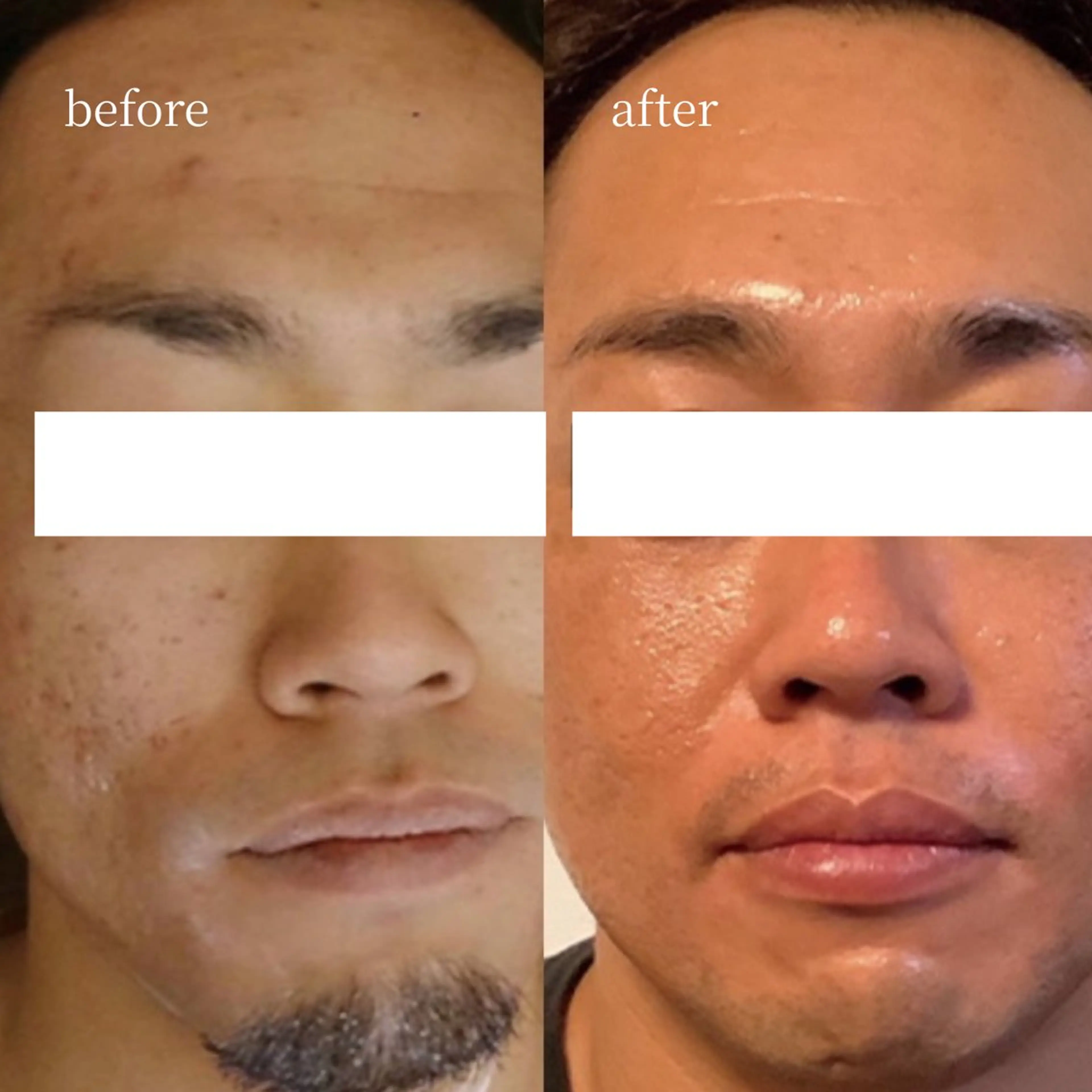 エステ 韓国肌管理・肌質改善 EARNEST心斎橋のエステ・リラクイメージ