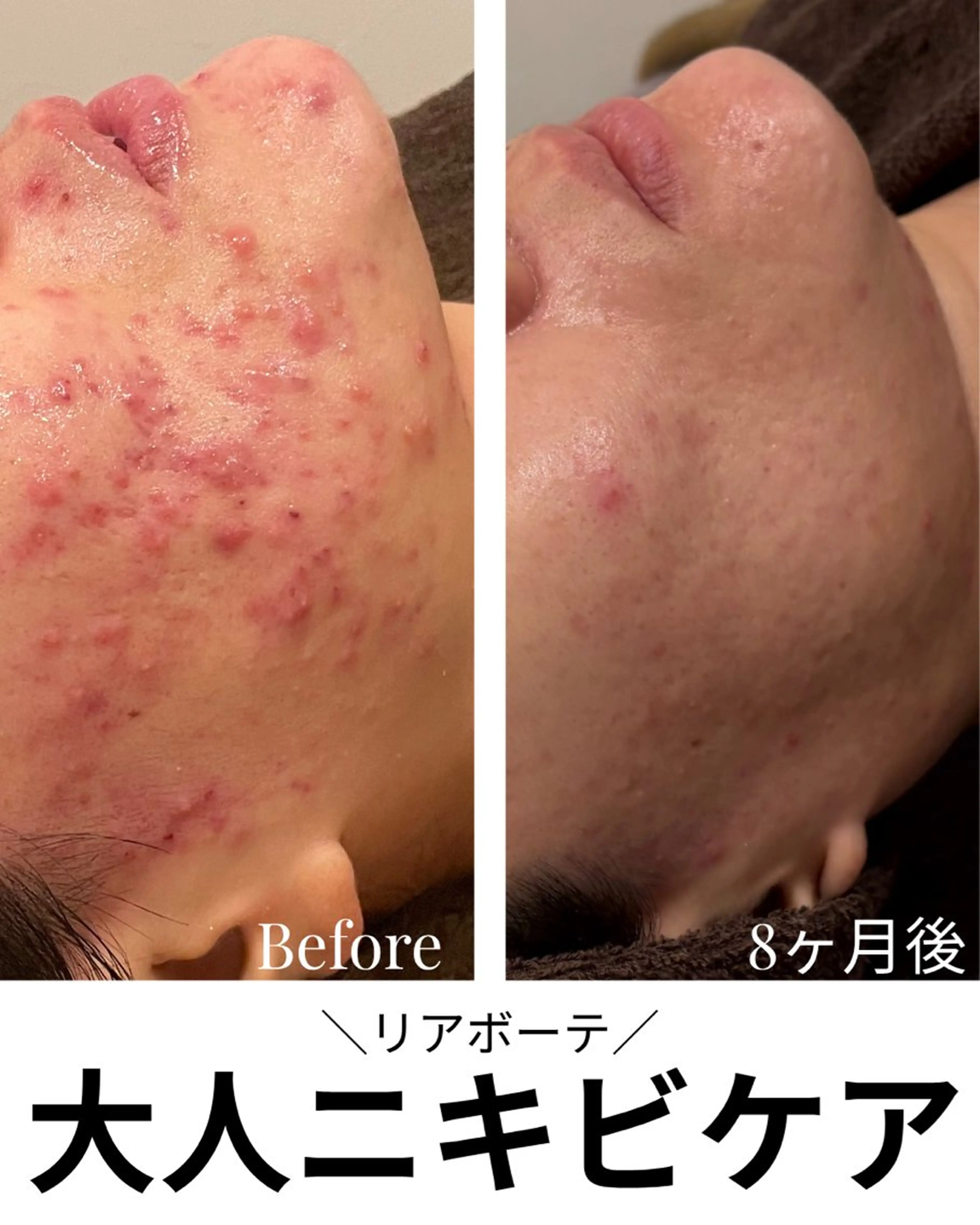 エステ リラク 浜野 恵美のエステ・リラクイメージ