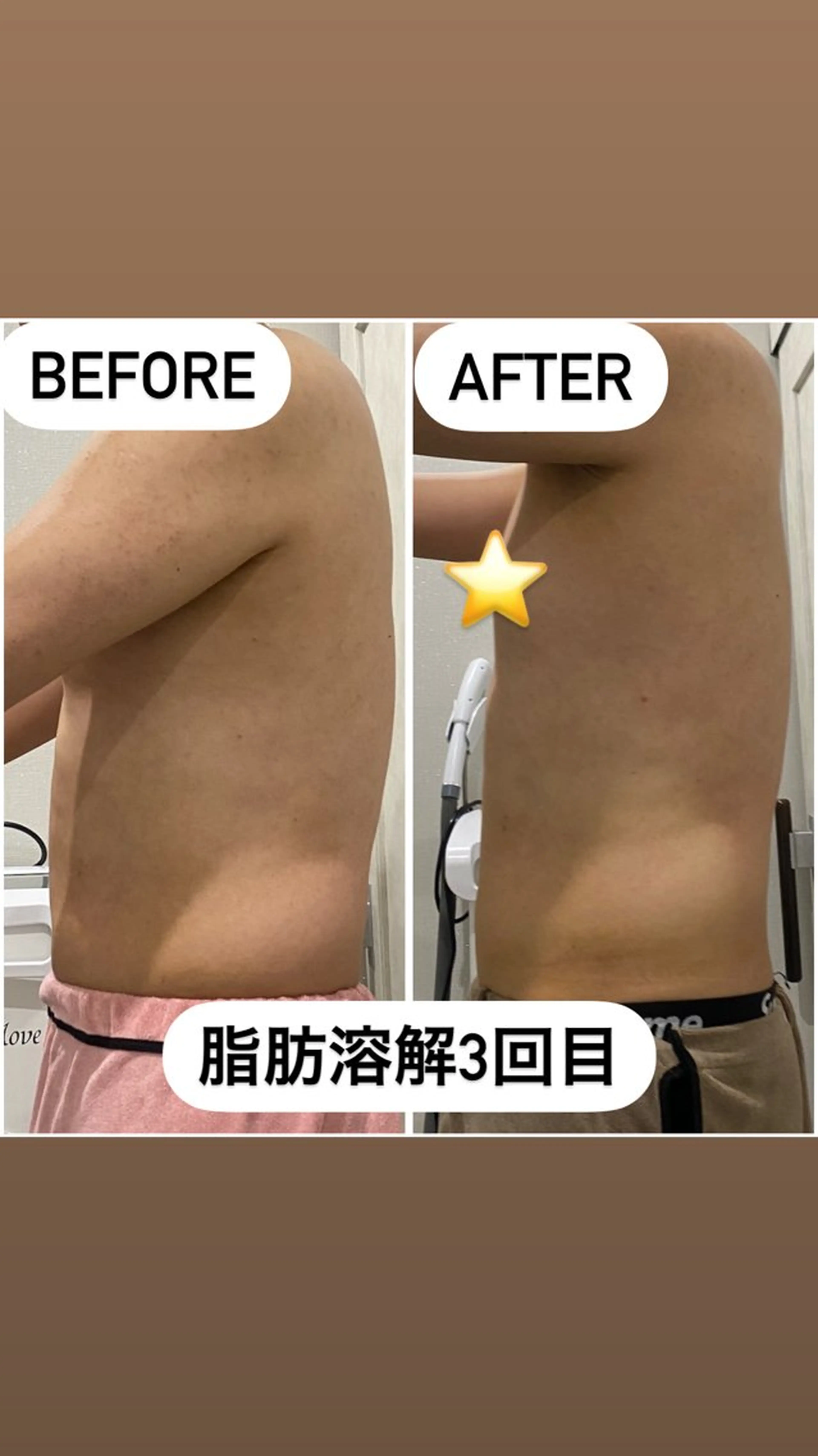 エステ 痩身/毛穴洗浄/脱毛 アルカンジュのエステ・リラクイメージ