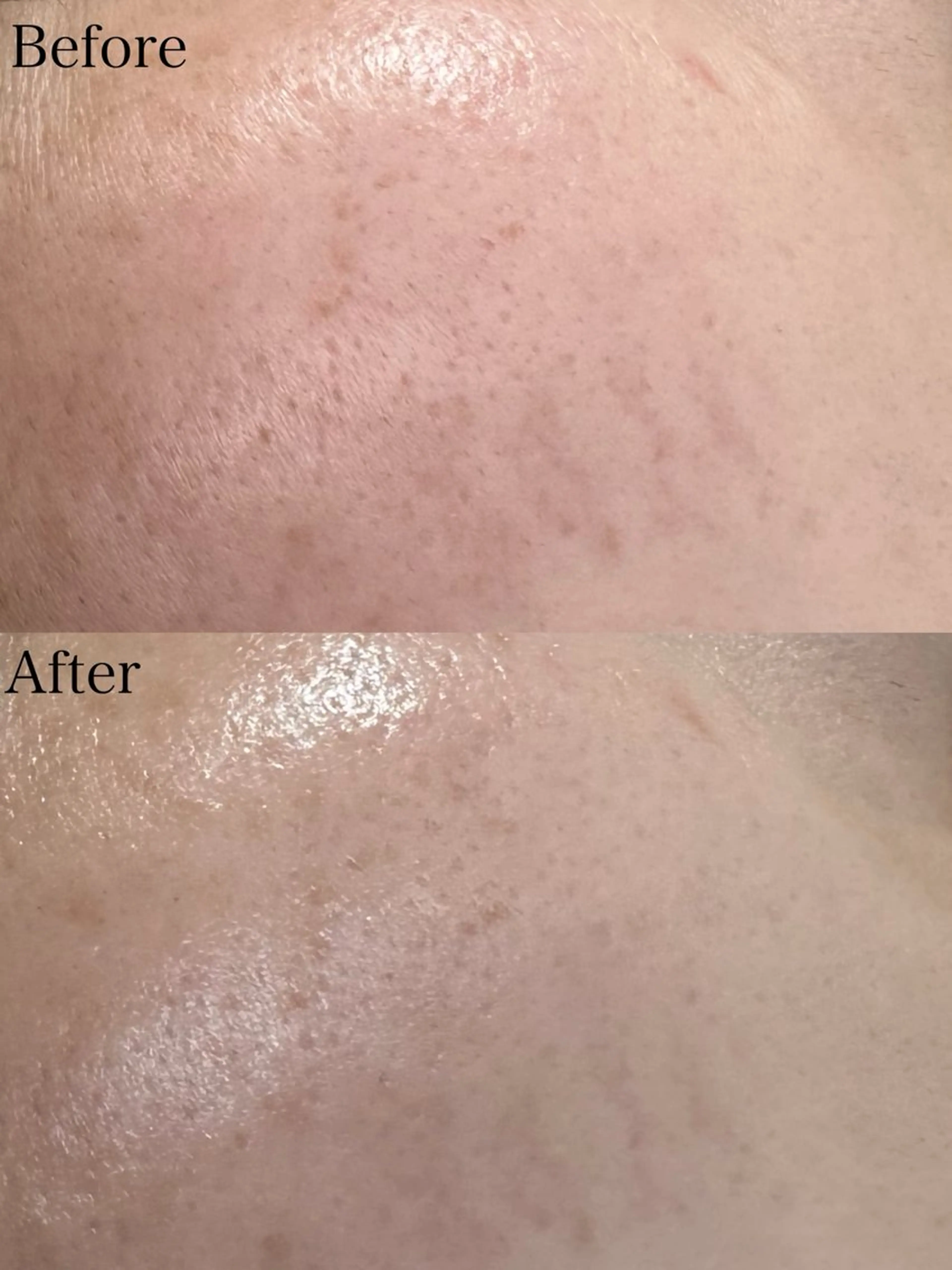 エステ beautysalon LIMOA所属・松本 愛絵理のエステ・リラクイメージ