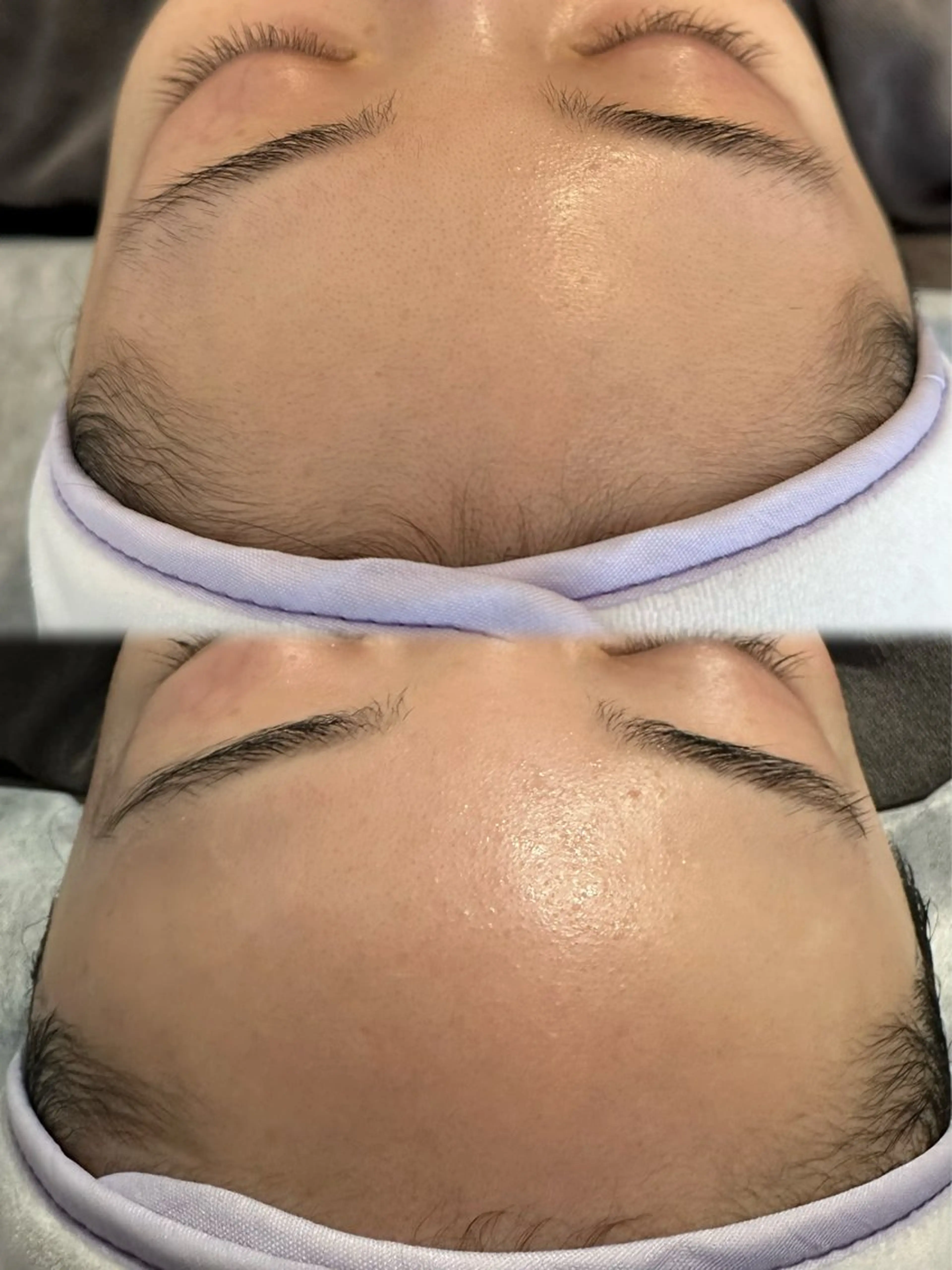 頭皮・薄毛改善サロン ｜眉毛｜痩身のエステ・リラクイメージ