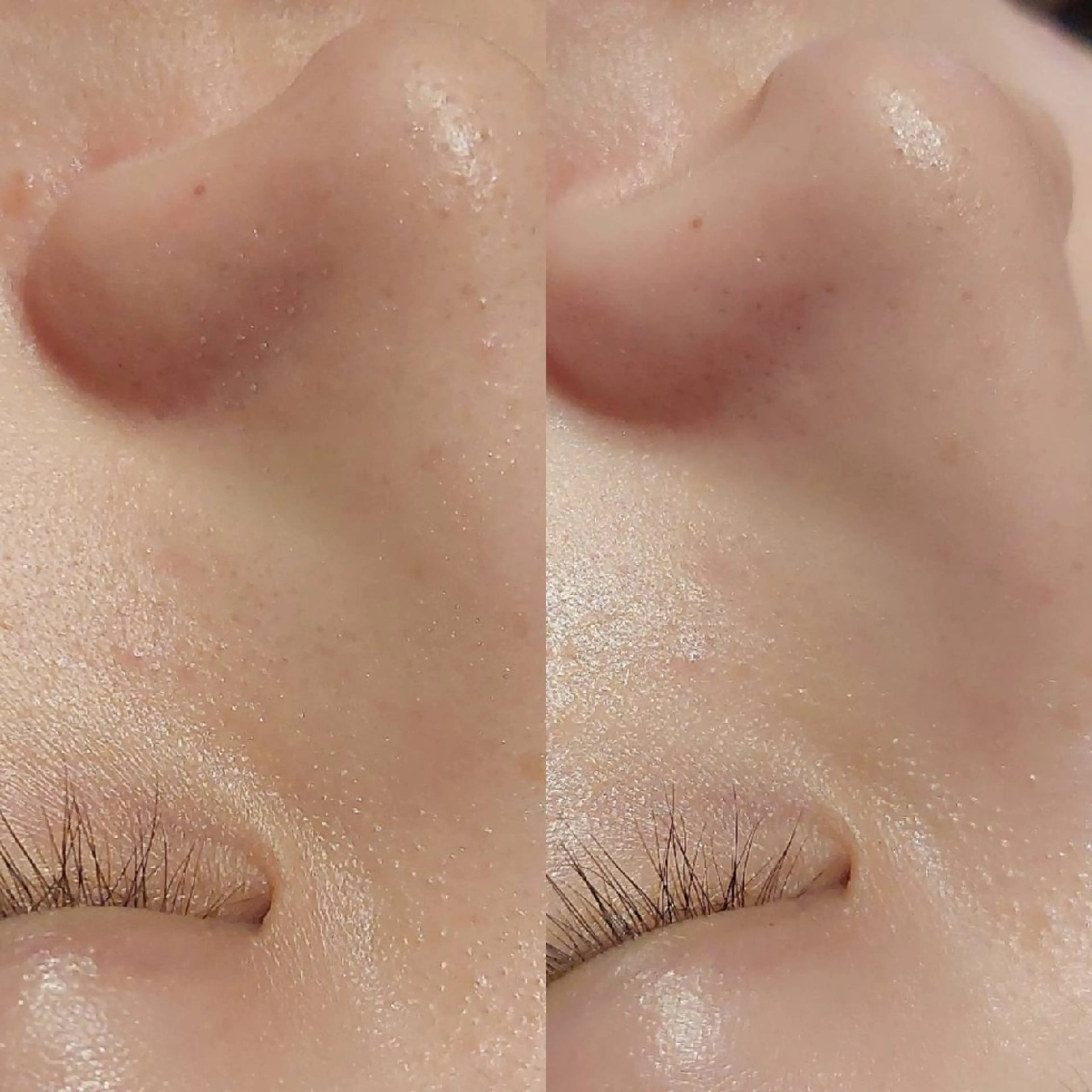 エステ MyFairLady miuのエステ・リラクイメージ