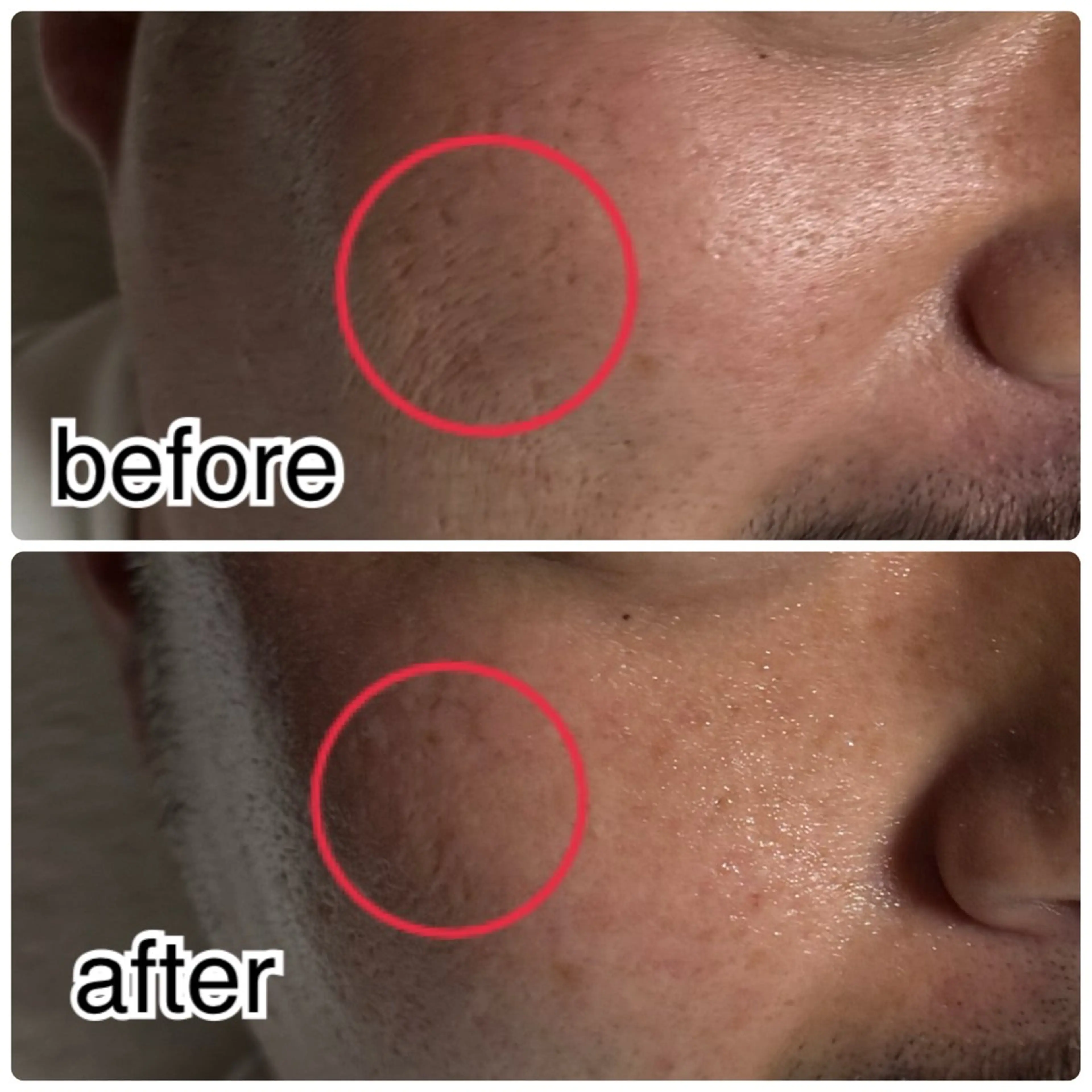 ROR Nanaのネイルデザイン