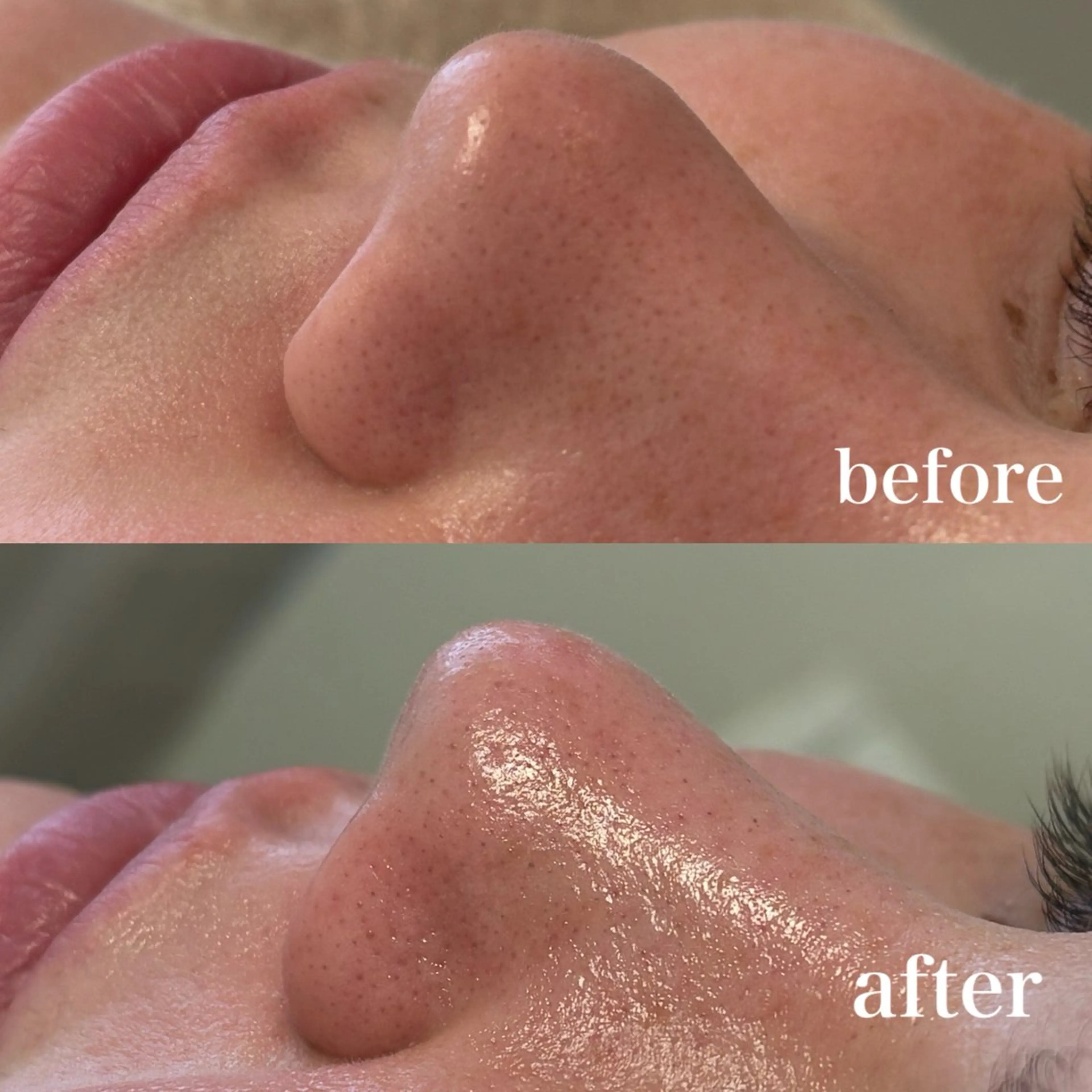 エステ 美養HAREHADA 🫧/ Ibukiの眉毛・アイブロウイメージ