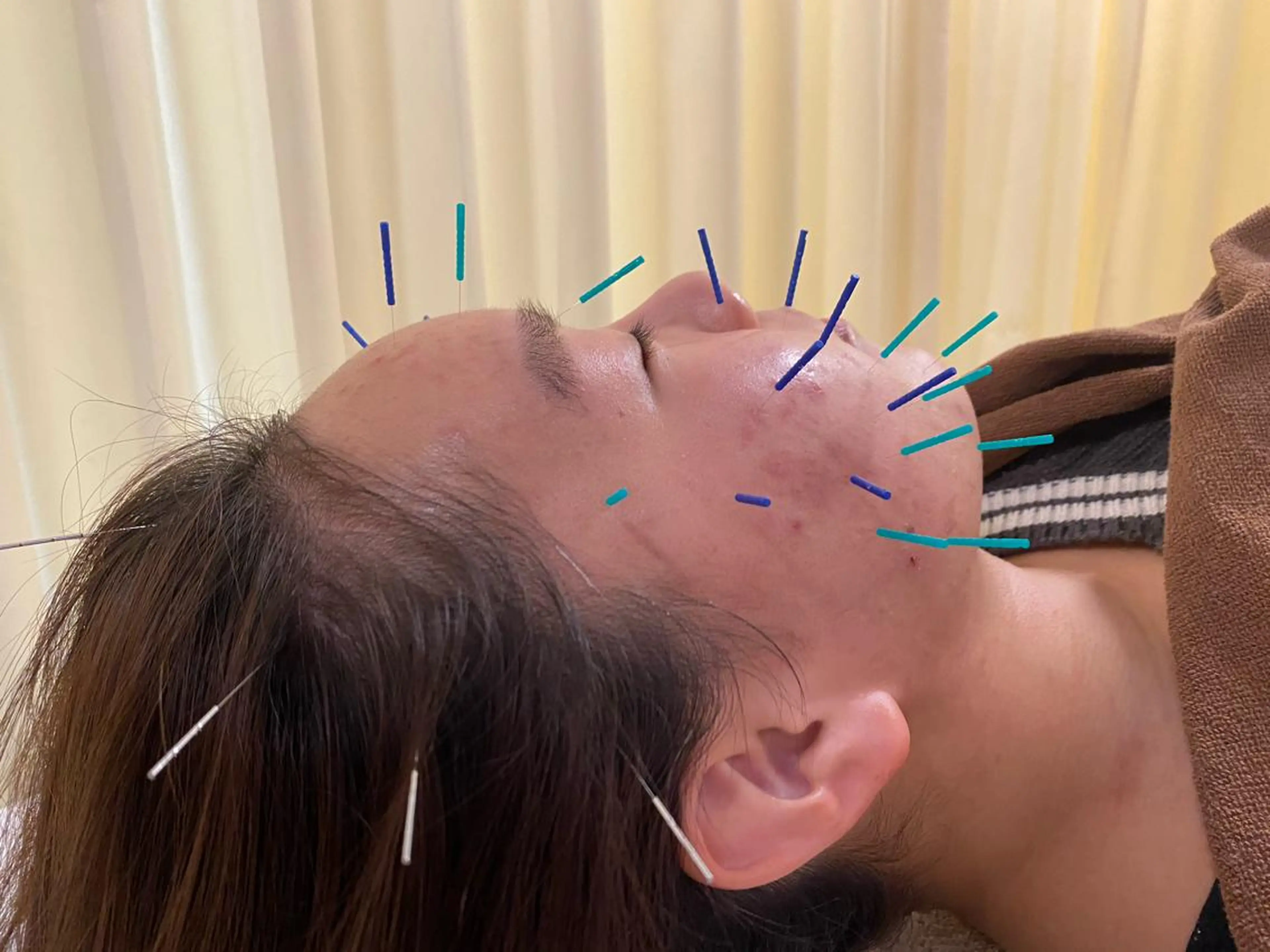 鍼灸サロン BBB3のその他イメージ