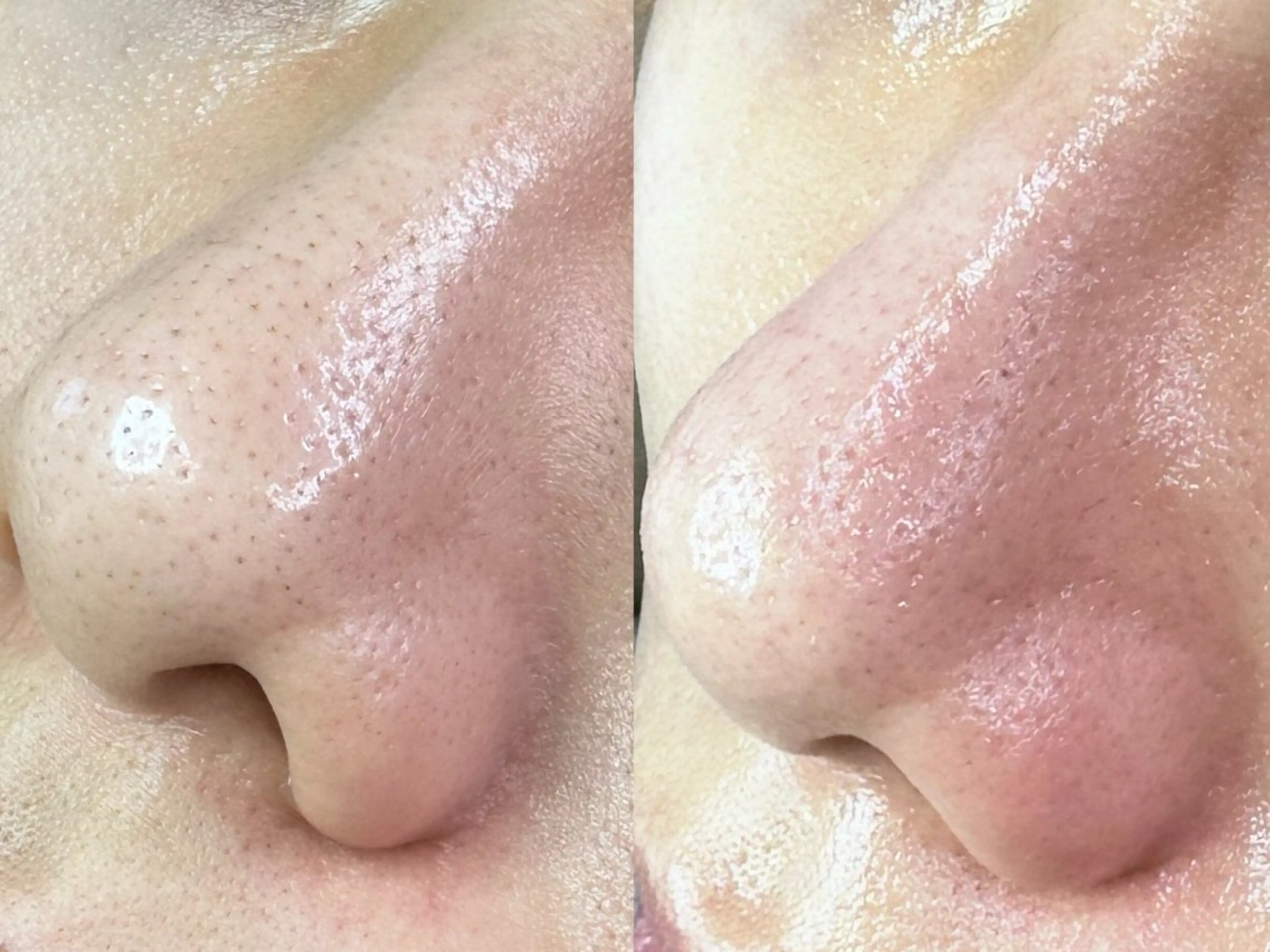 エステ 大久保 里奈のエステ・リラクイメージ