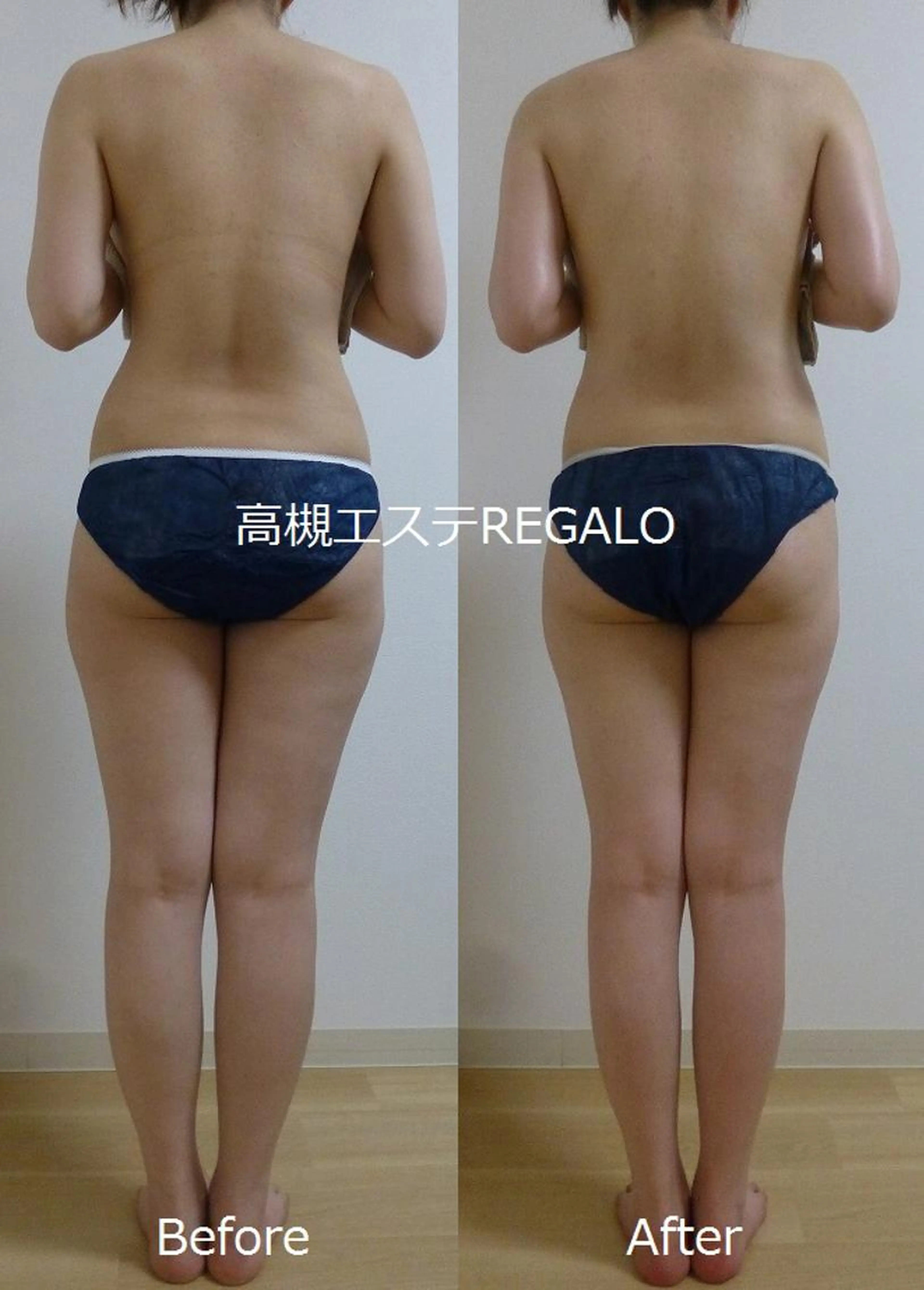 【体質改善+全身スリム 毎月3名限定】ブライダルの方などにオススメ!!!!☆初回特別価格☆全身痩せスペシャルコースの写真