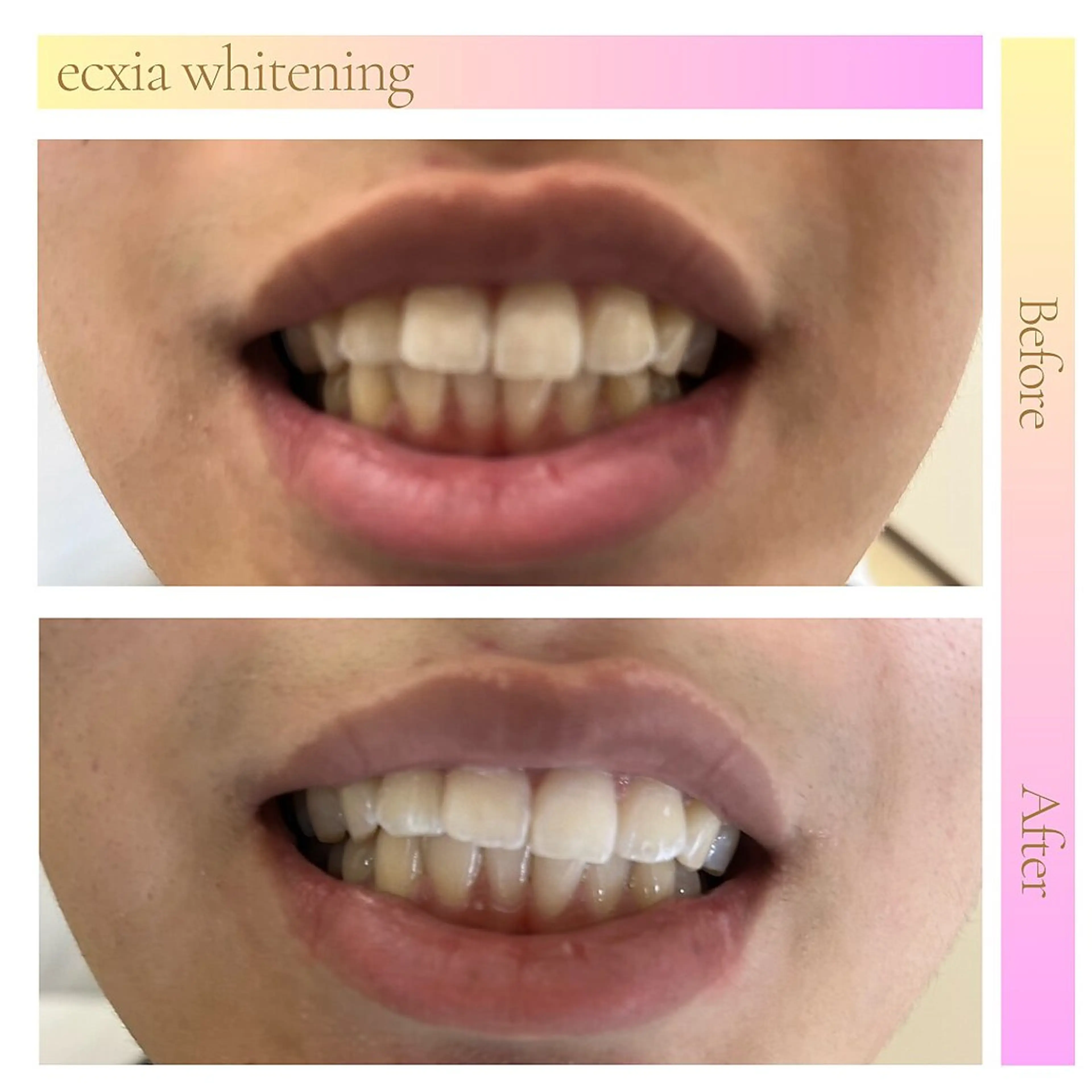 その他 セルフホワイトニングサロン　エクシアホワイト西尾店所属・エクシアホワイト西尾 堀内恵のその他イメージ