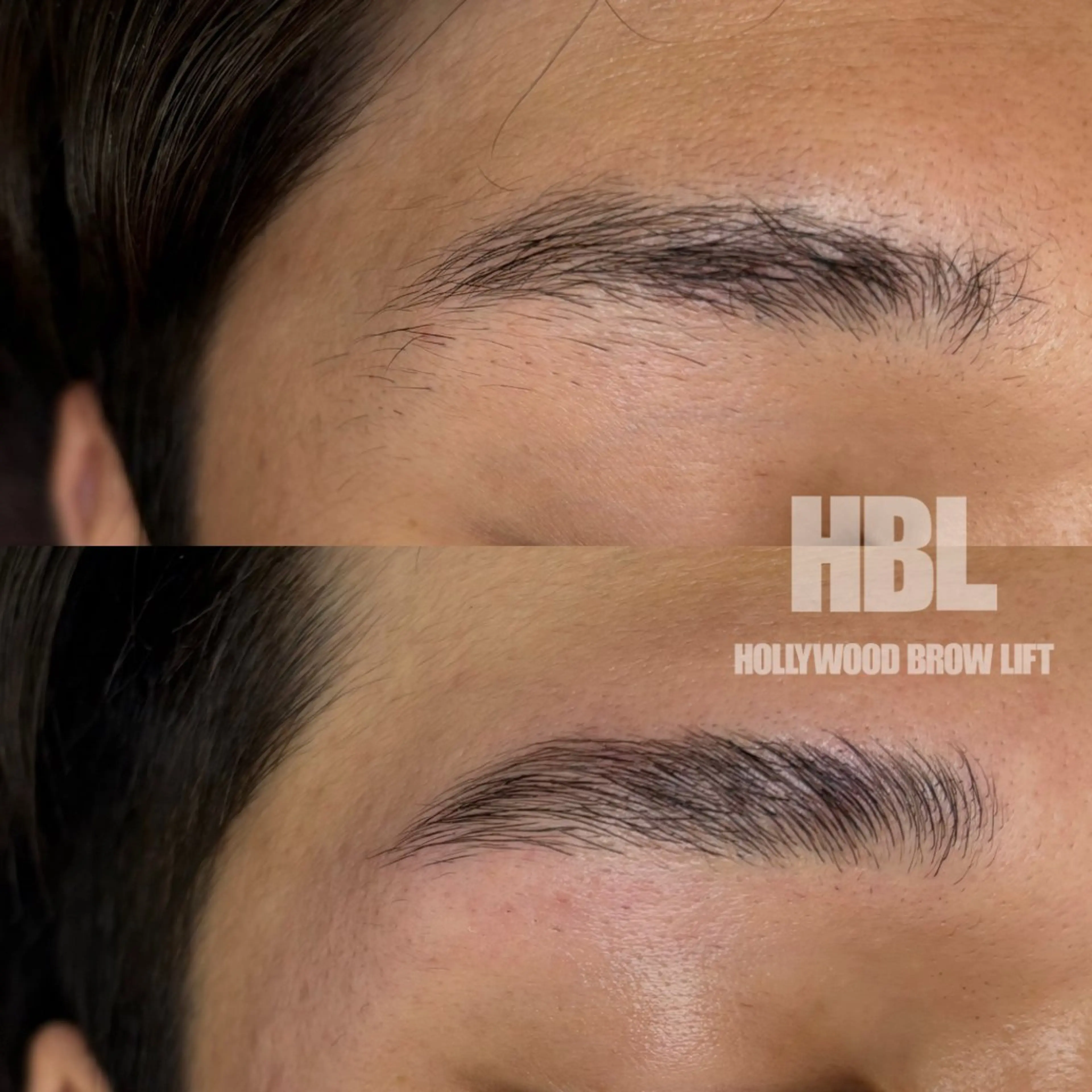 【男性】眉癖改善ハリウッドブロウリフトの写真