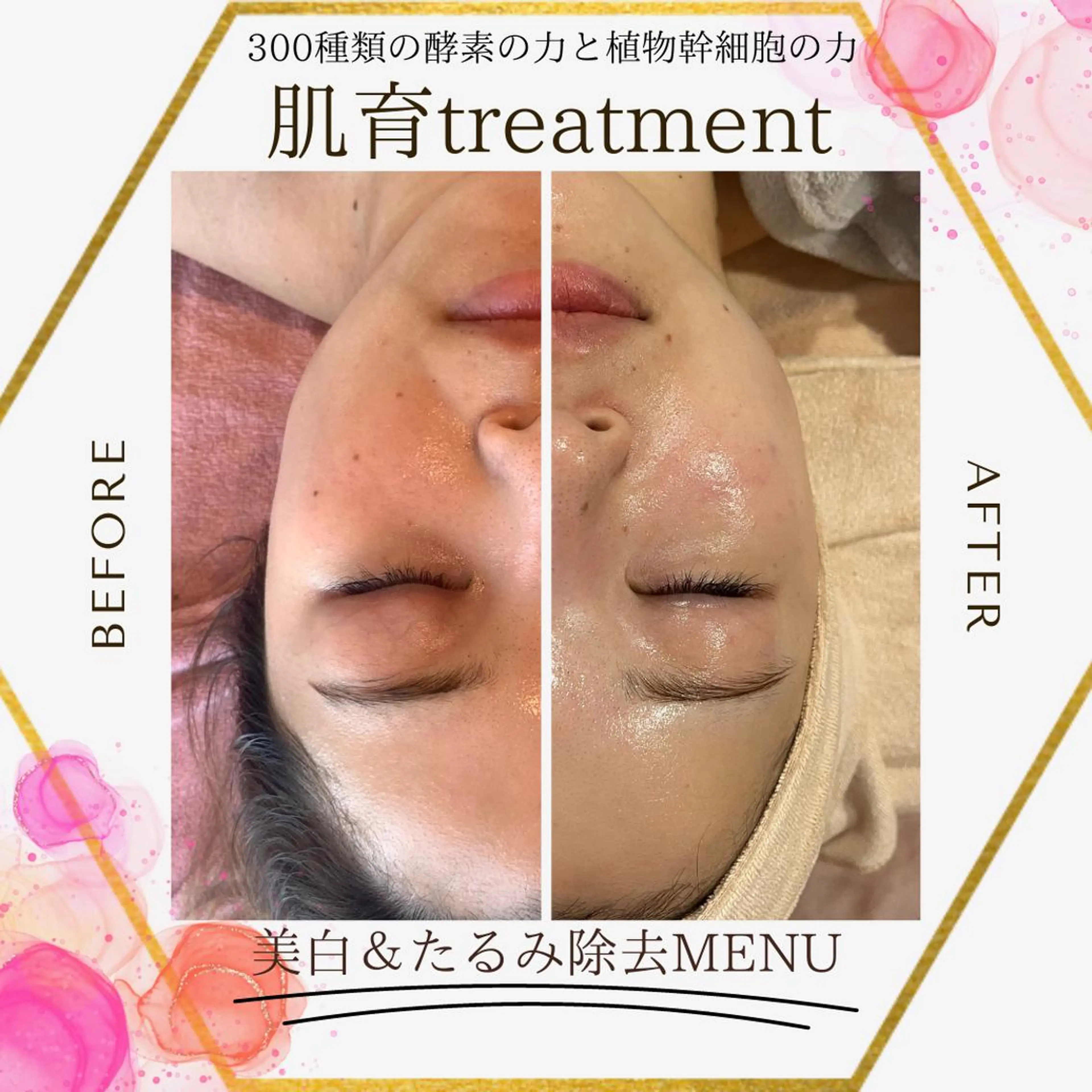 陶肌トリートメント小顔　cycayコース🌹の写真