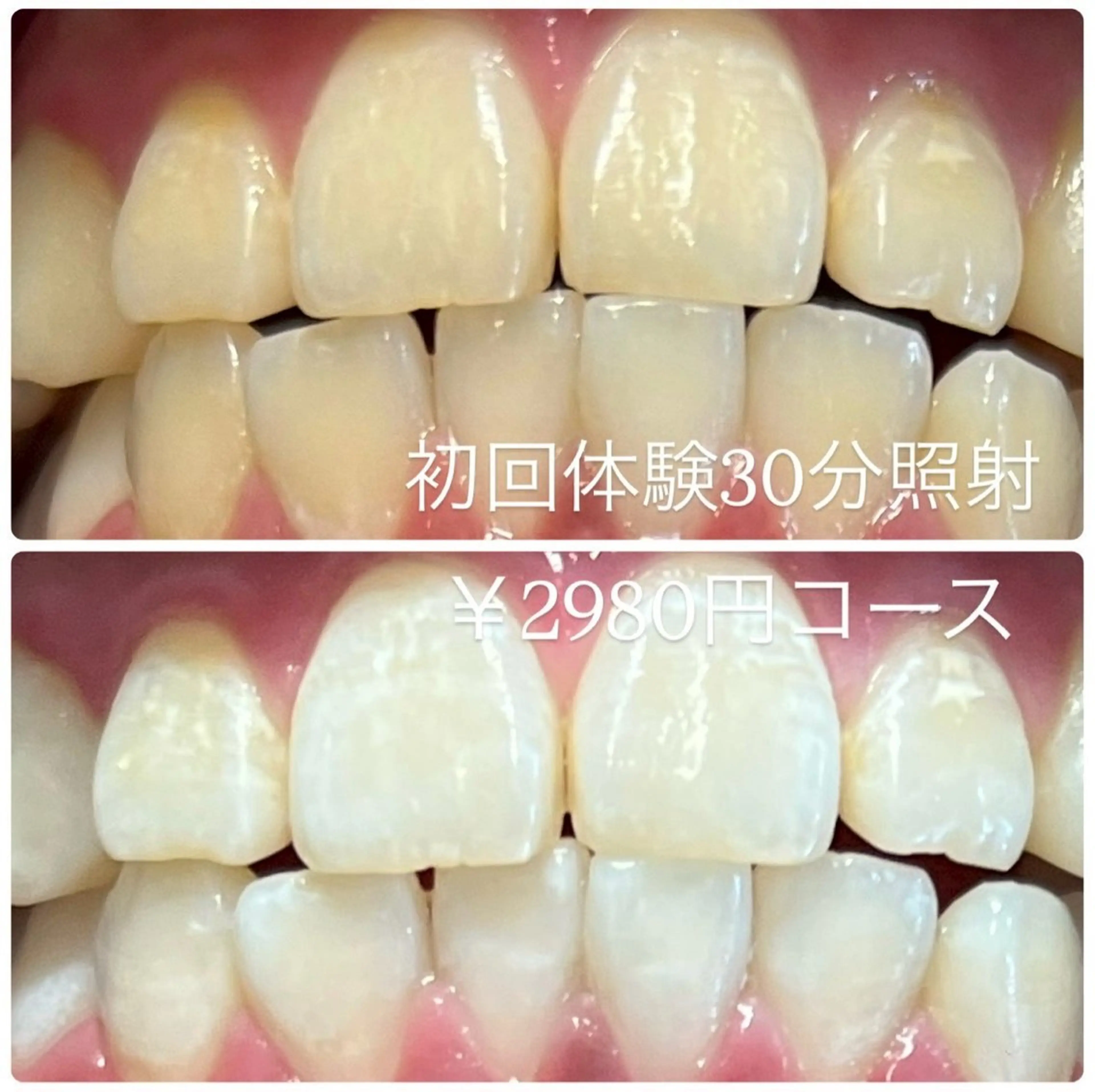 その他 ホワイトニングルーム 横浜店のその他イメージ