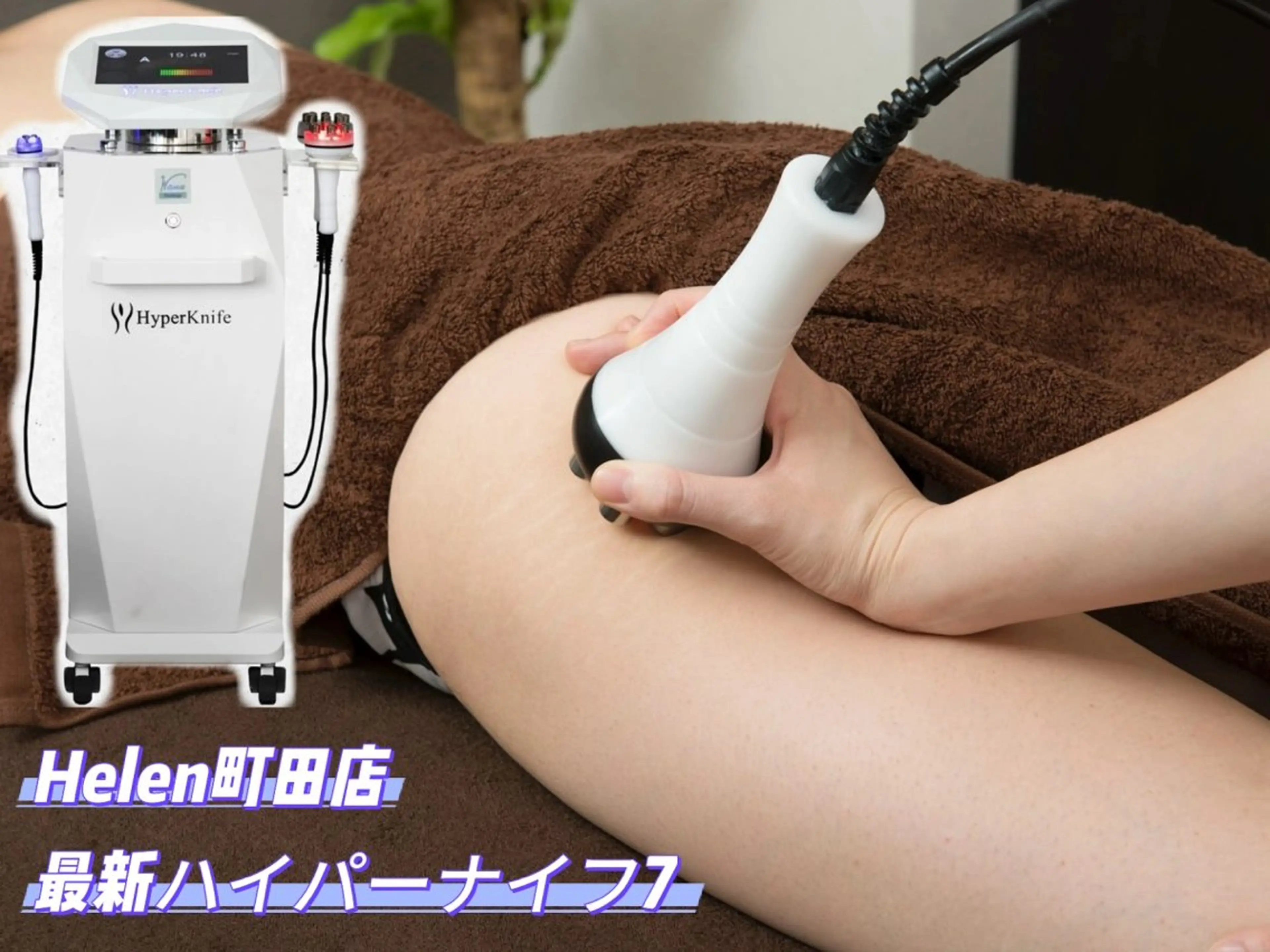 before/after【本気の美脚】最新ハイパーナイフ2部位（太もも・ふくらはぎ）+下半身リンパ60分の写真