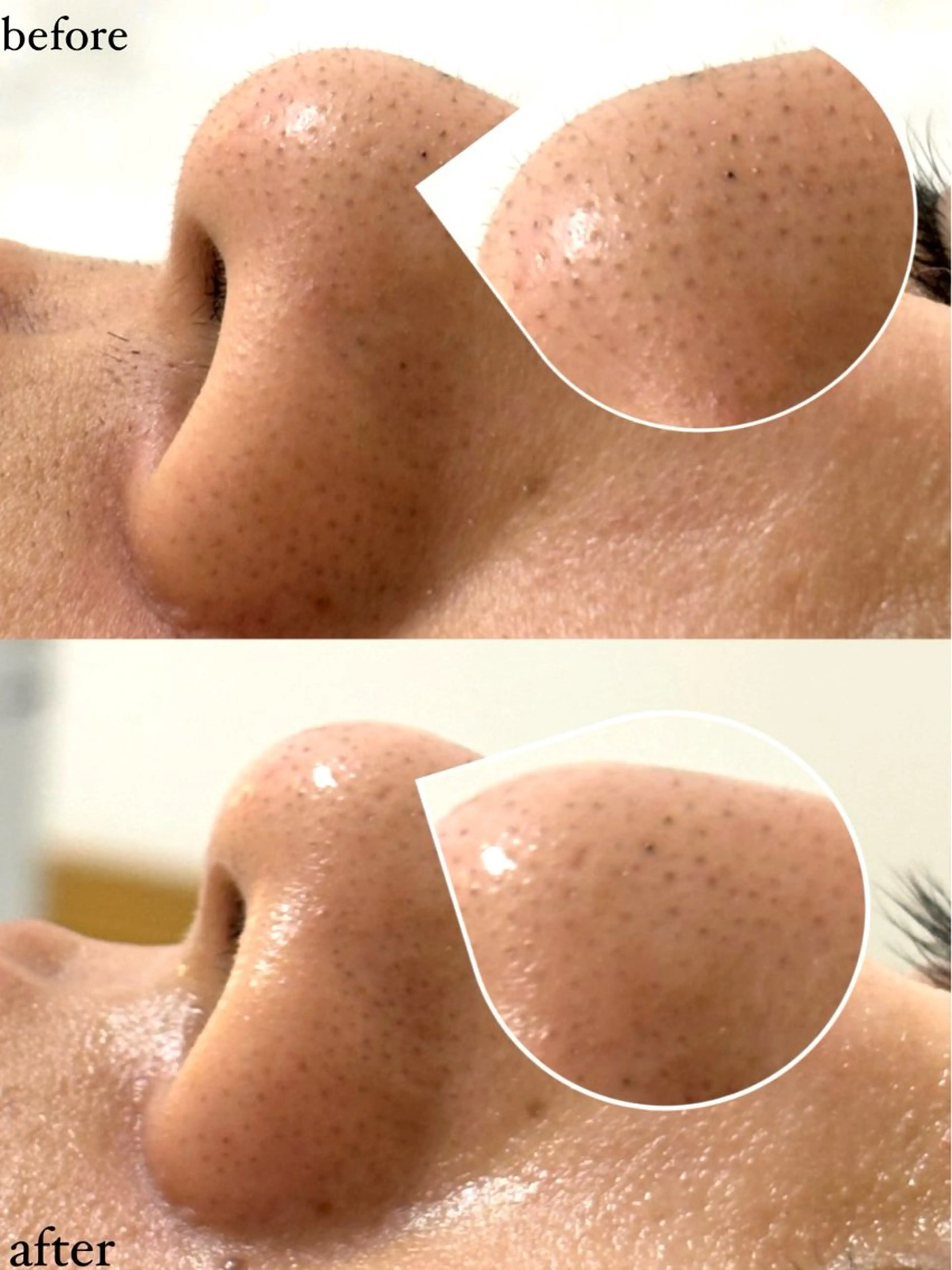 女性専門お顔剃り sunraineのエステ・リラクイメージ