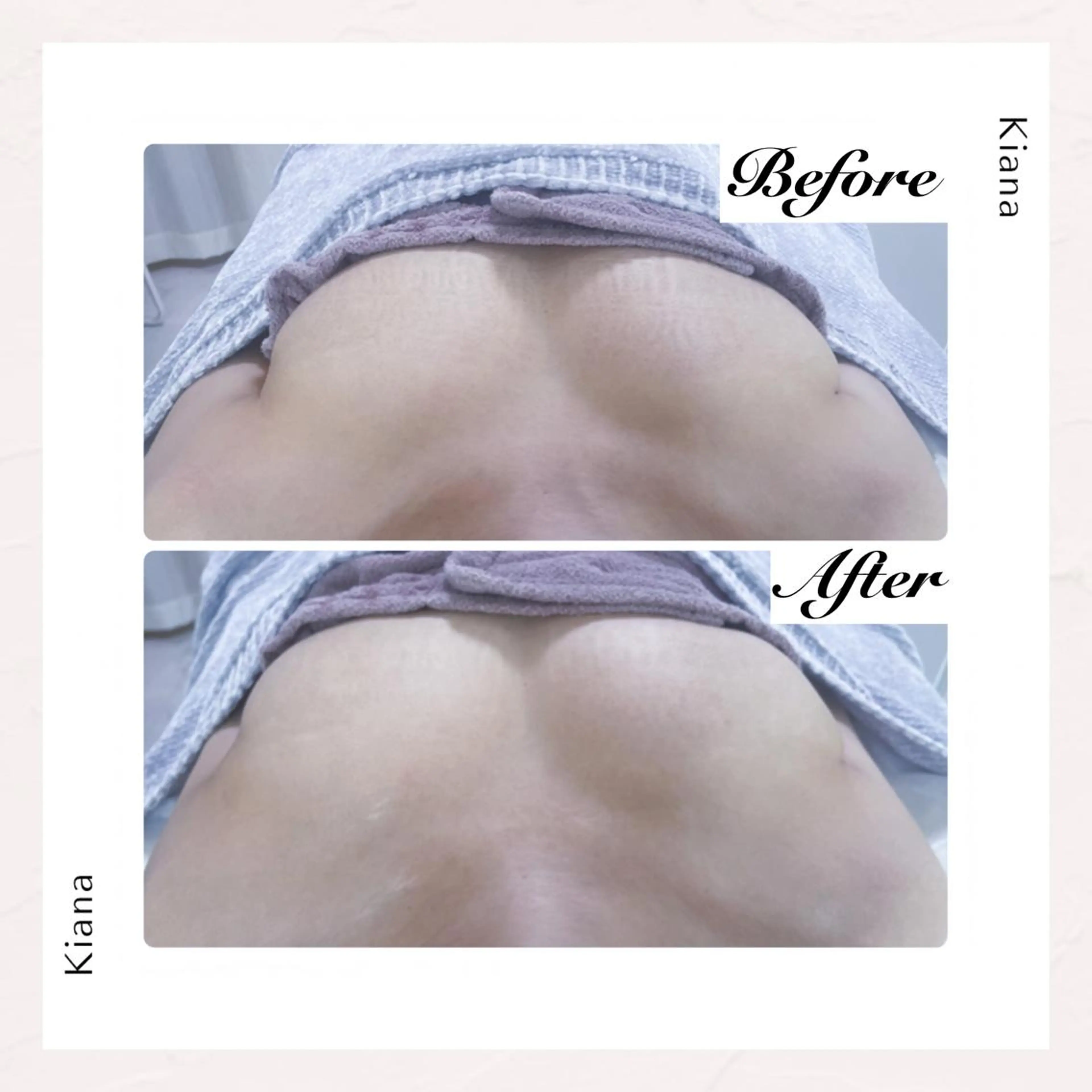 エステ リラク バスト専門Kiana 風のエステ・リラクイメージ