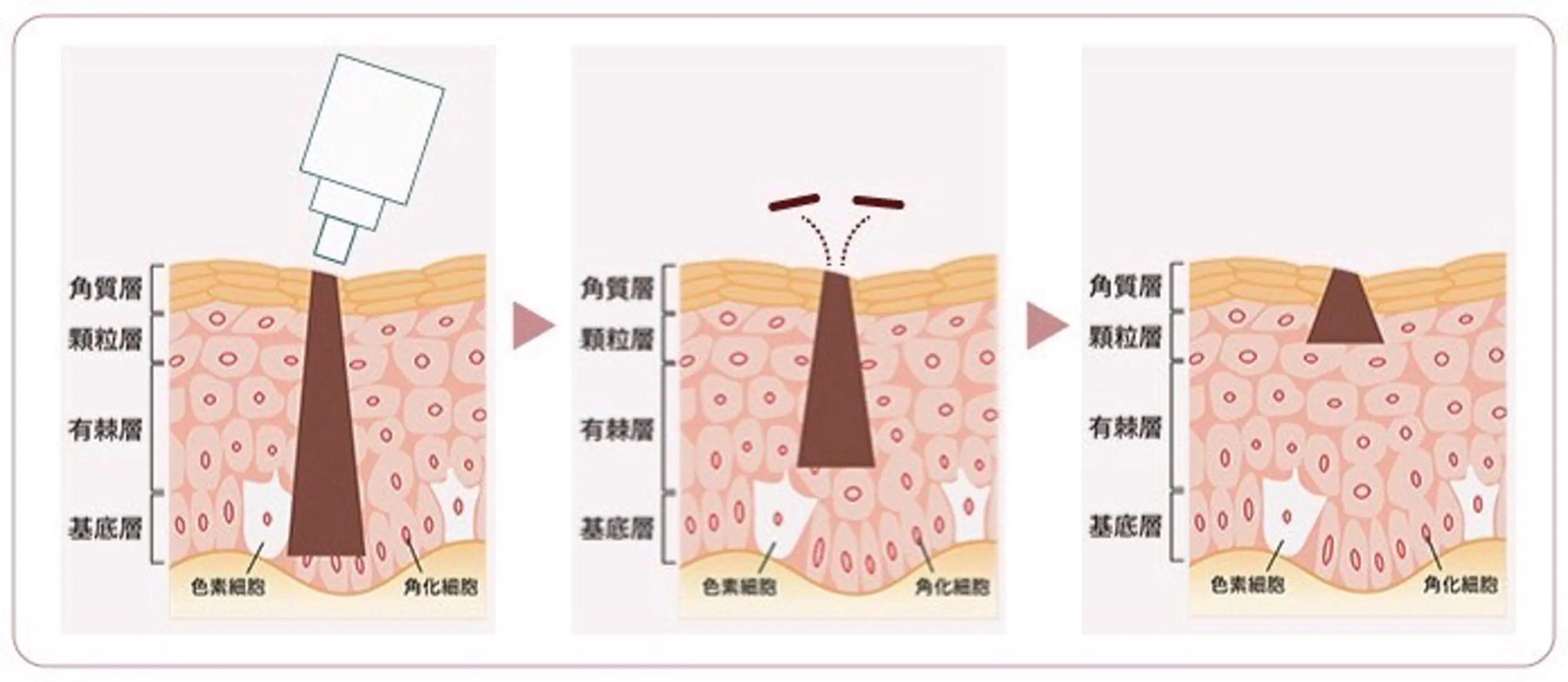 曽根 理奈のエステ・リラクイメージ