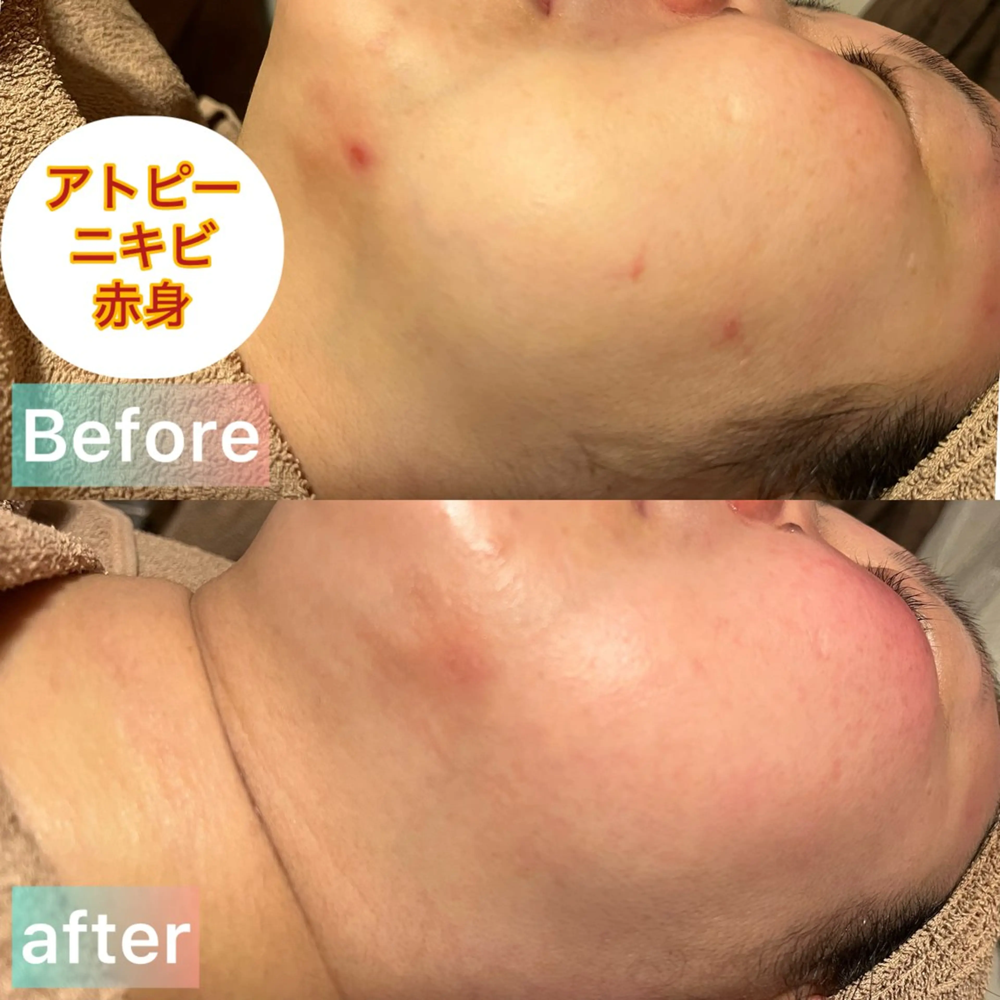 エステ LaBeIIevie ラベルヴィのマツエク・マツパデザイン