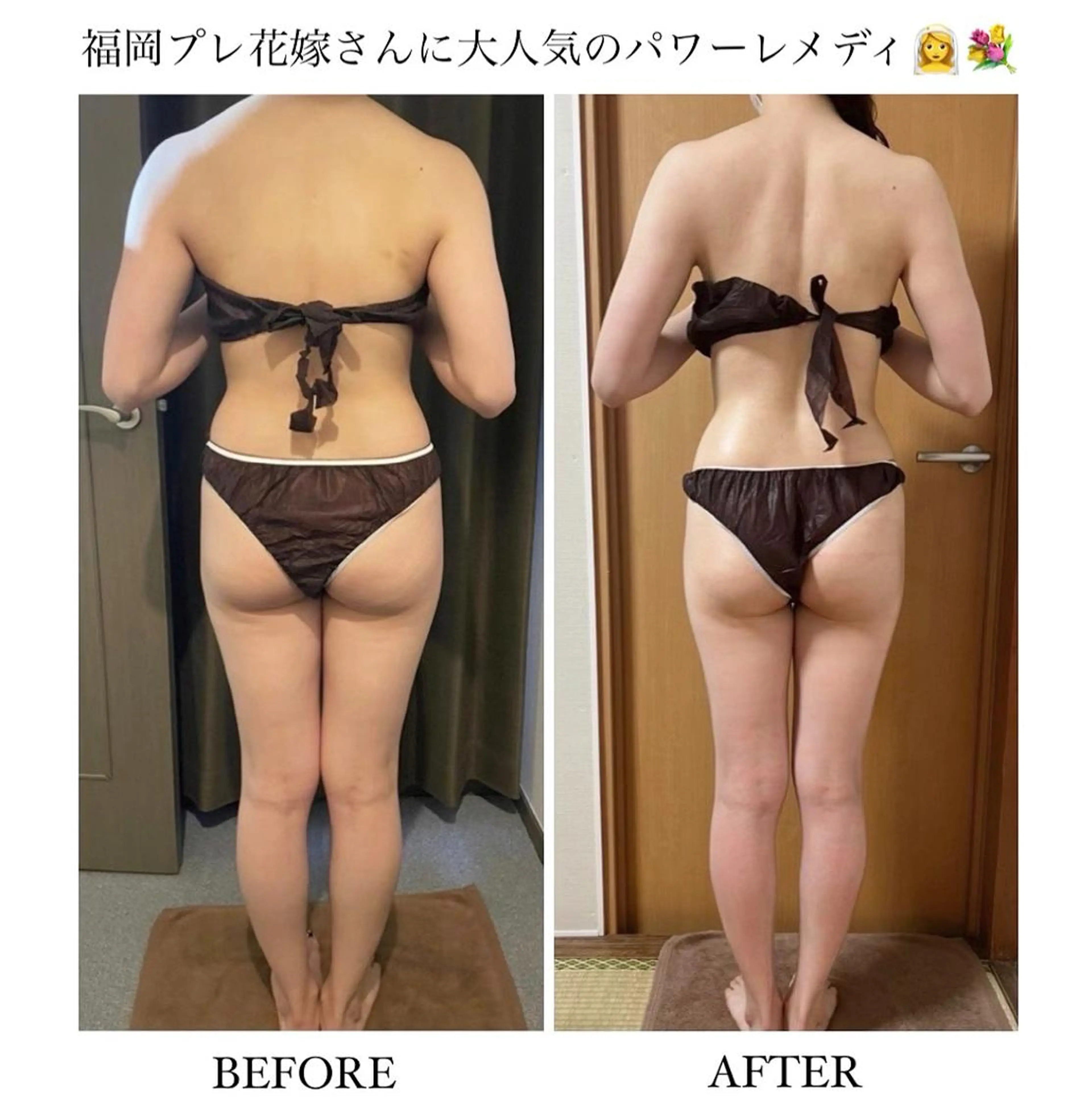 《本気痩せ×疲労改善 》  BILOOPのエステ・リラクイメージ