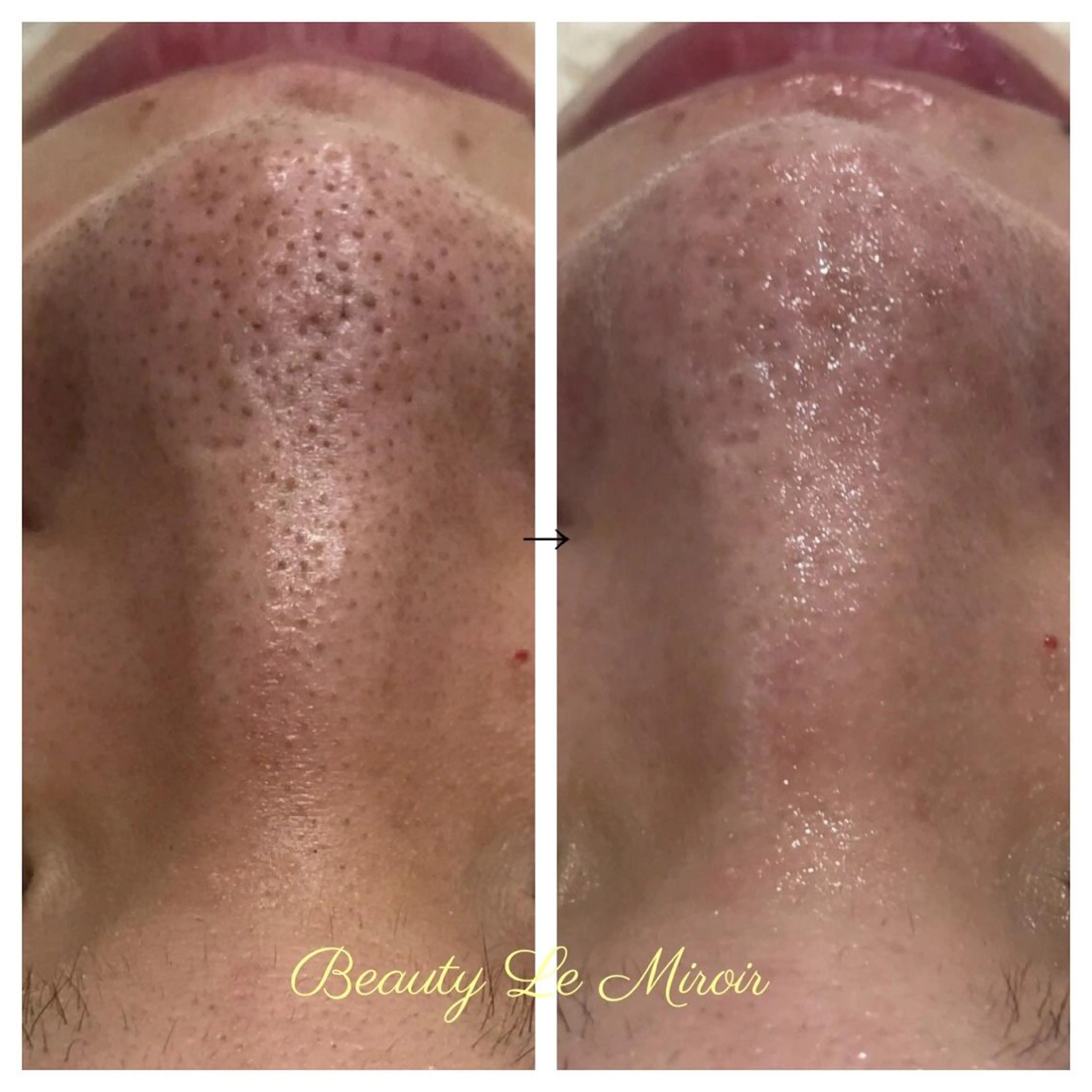 ビューティー ミロワールのエステ・リラクイメージ