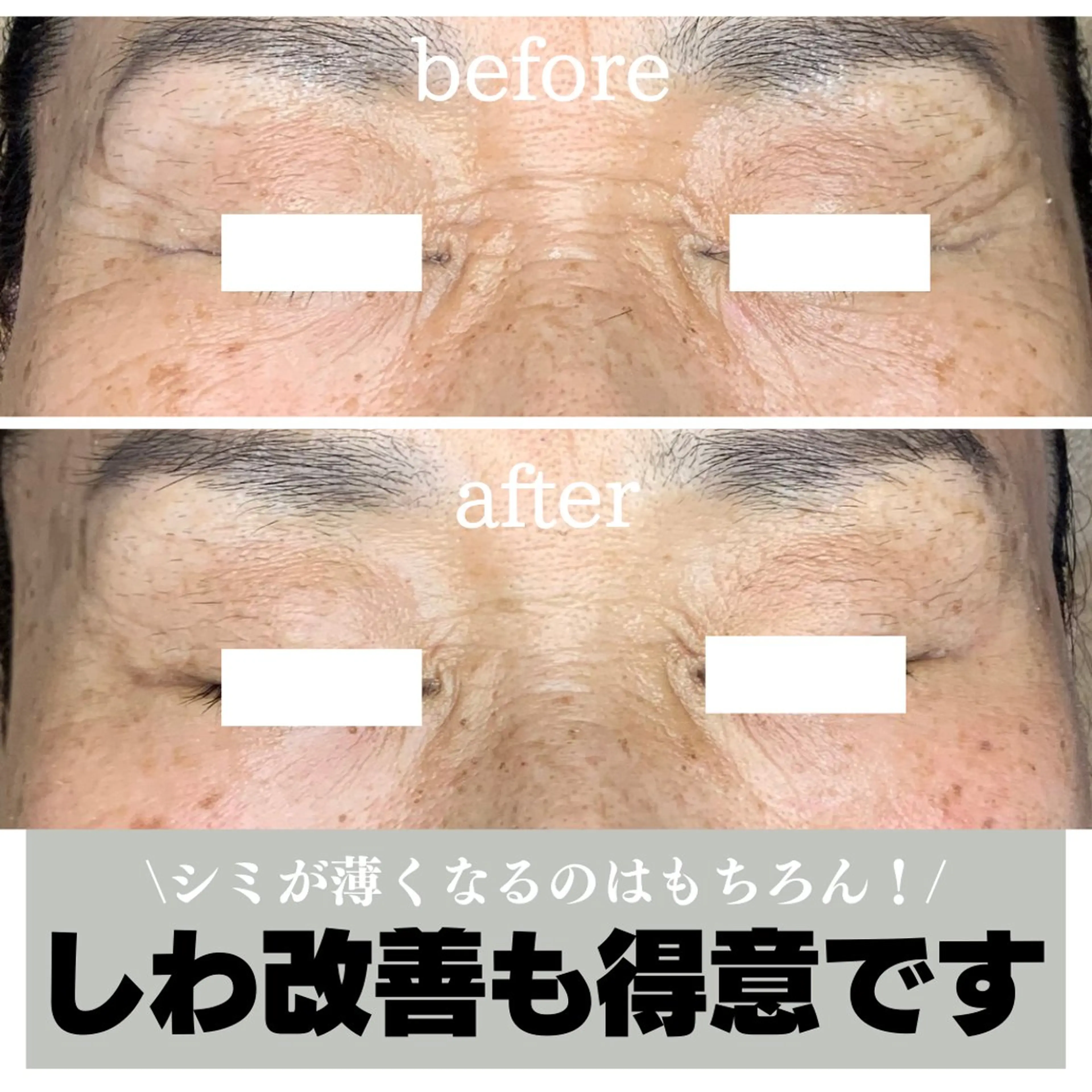 エステ 最新シミケアLily de pearlのエステ・リラクイメージ