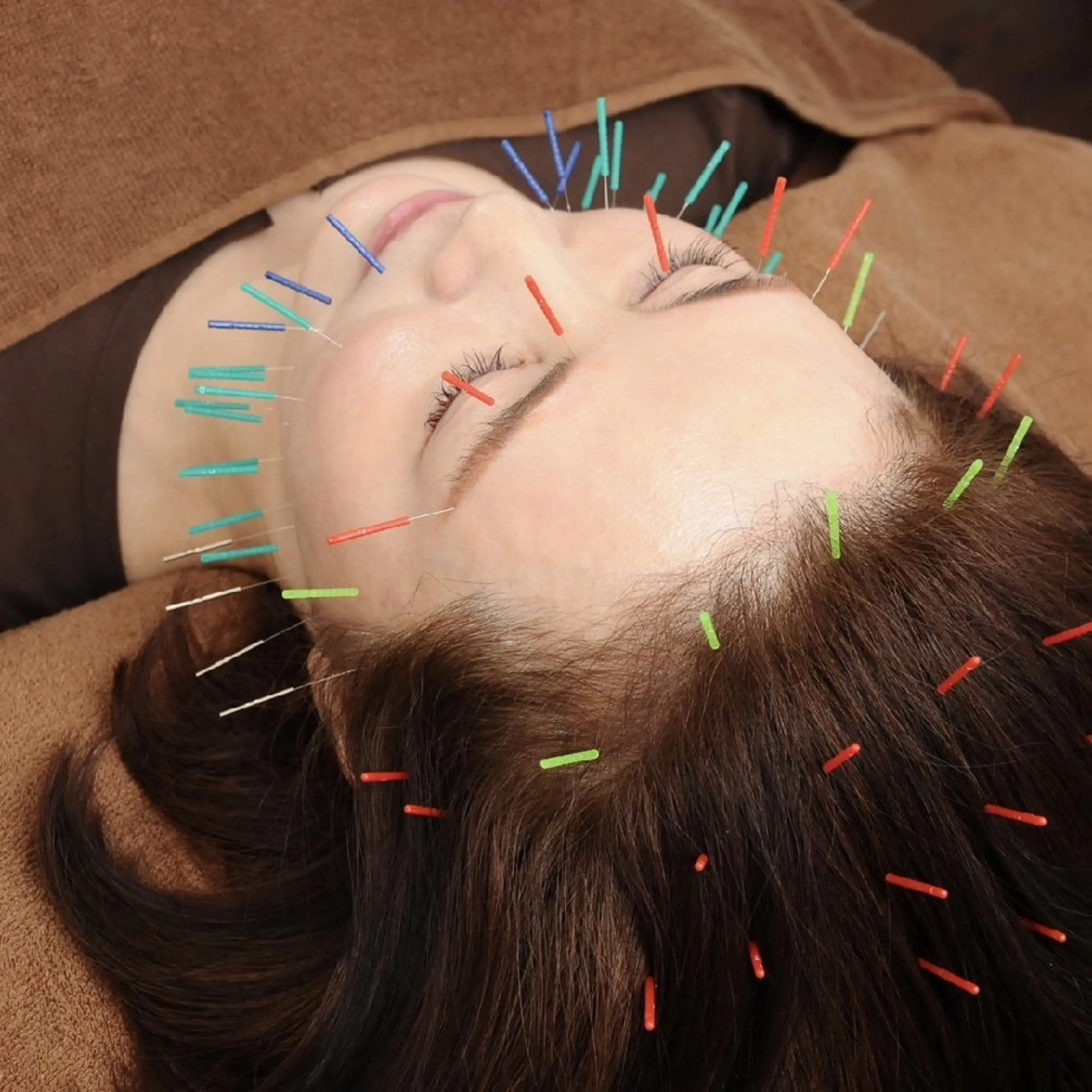 エステ リラク Spring鍼灸院 ✨首肩こり、腰痛に！のその他イメージ