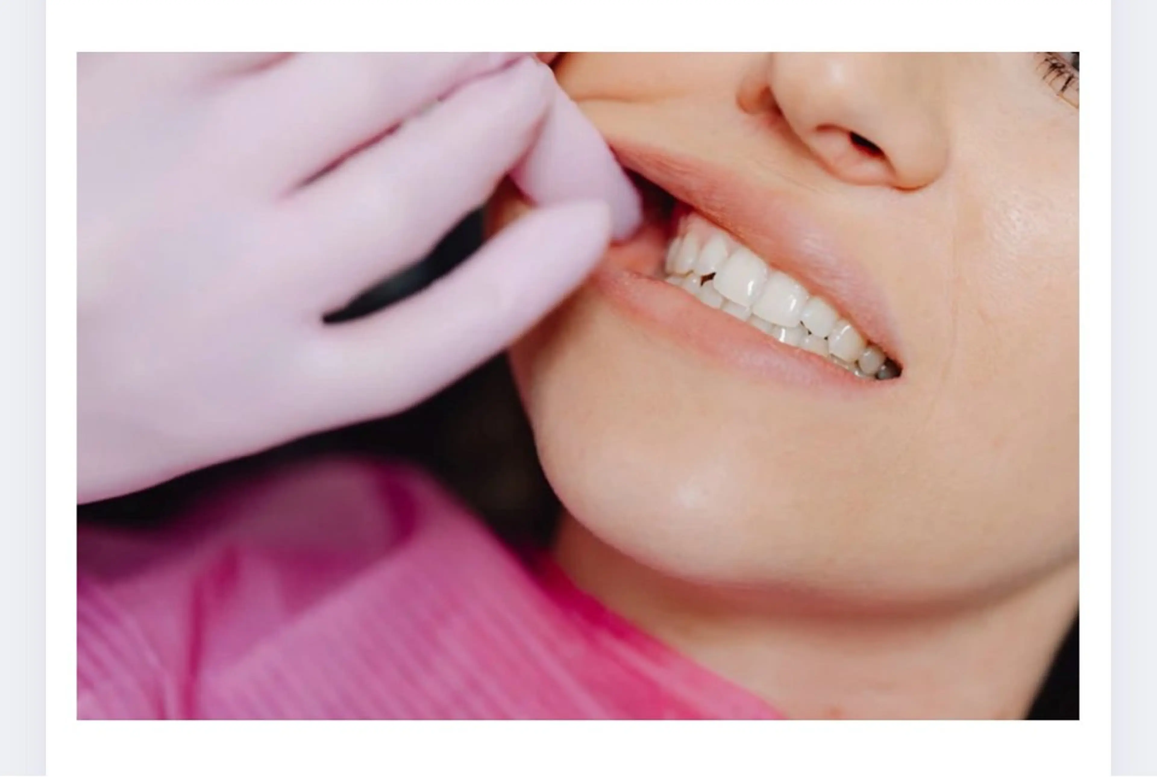 リラク 口腔エステ リハセラのエステ・リラクイメージ