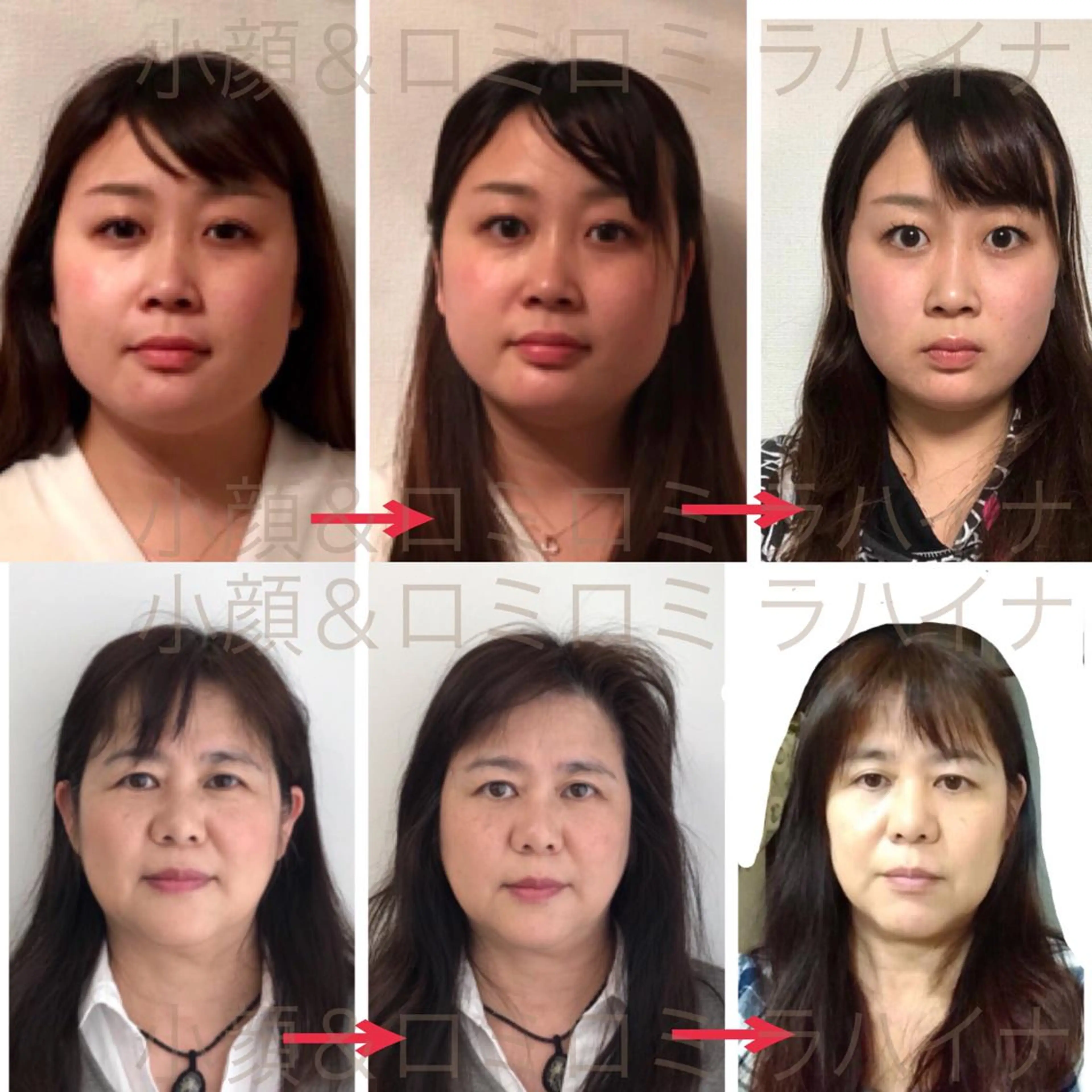 【限定モニター初回価格】 痛くない小顔矯正 ⭐︎たるみ、むくみ、二重顎、法令線、エラ張り対応　結果重視小顔マッサージの写真