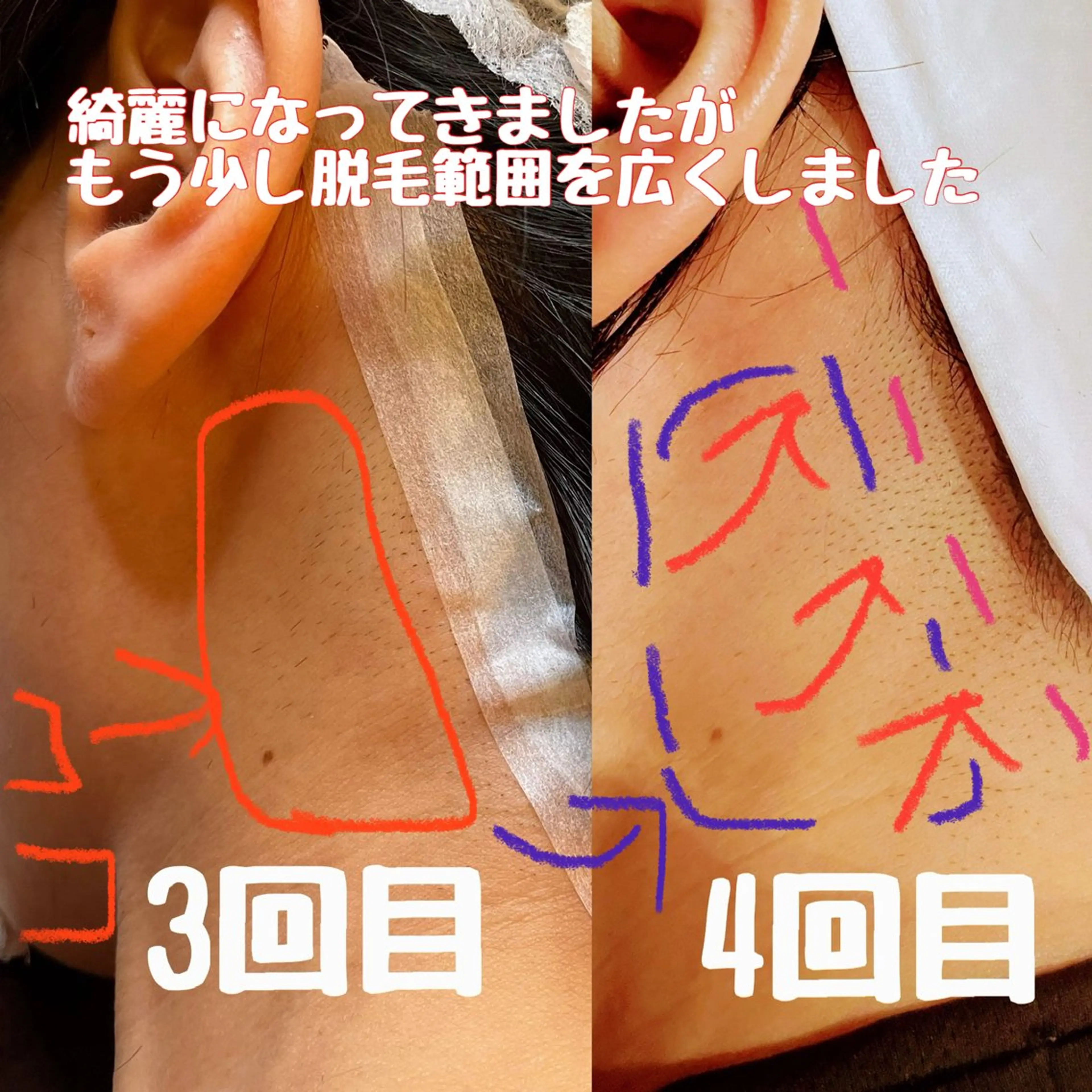 エステ アロマセラピー&エステティック　プチ・ソメイユ所属・桑山 ユミのその他イメージ